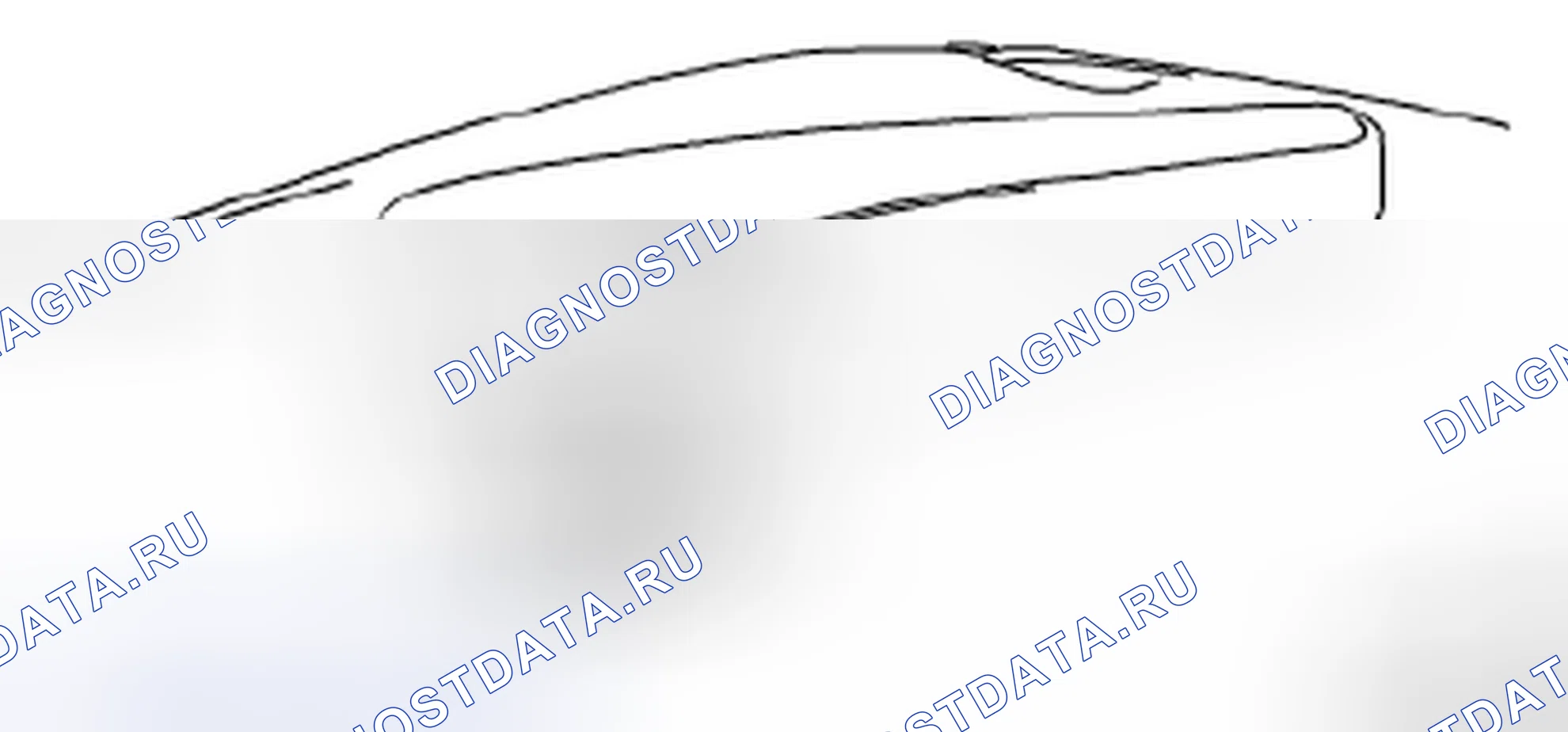 Рис. 6: Демонтаж. Suzuki Forenza I