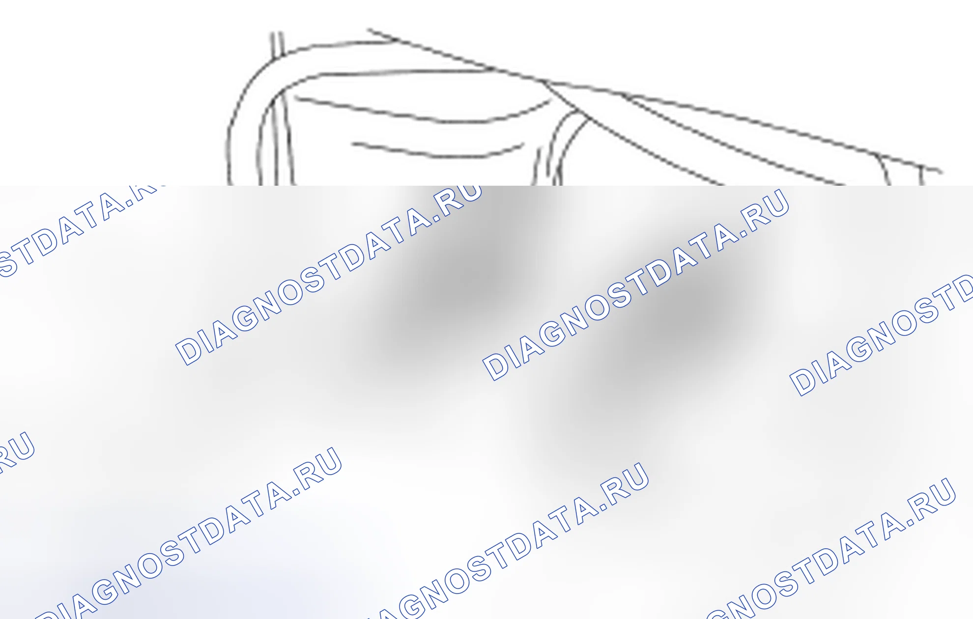 Рис. 8: Демонтаж и монтаж. Hyundai Matrix I рестайлинг