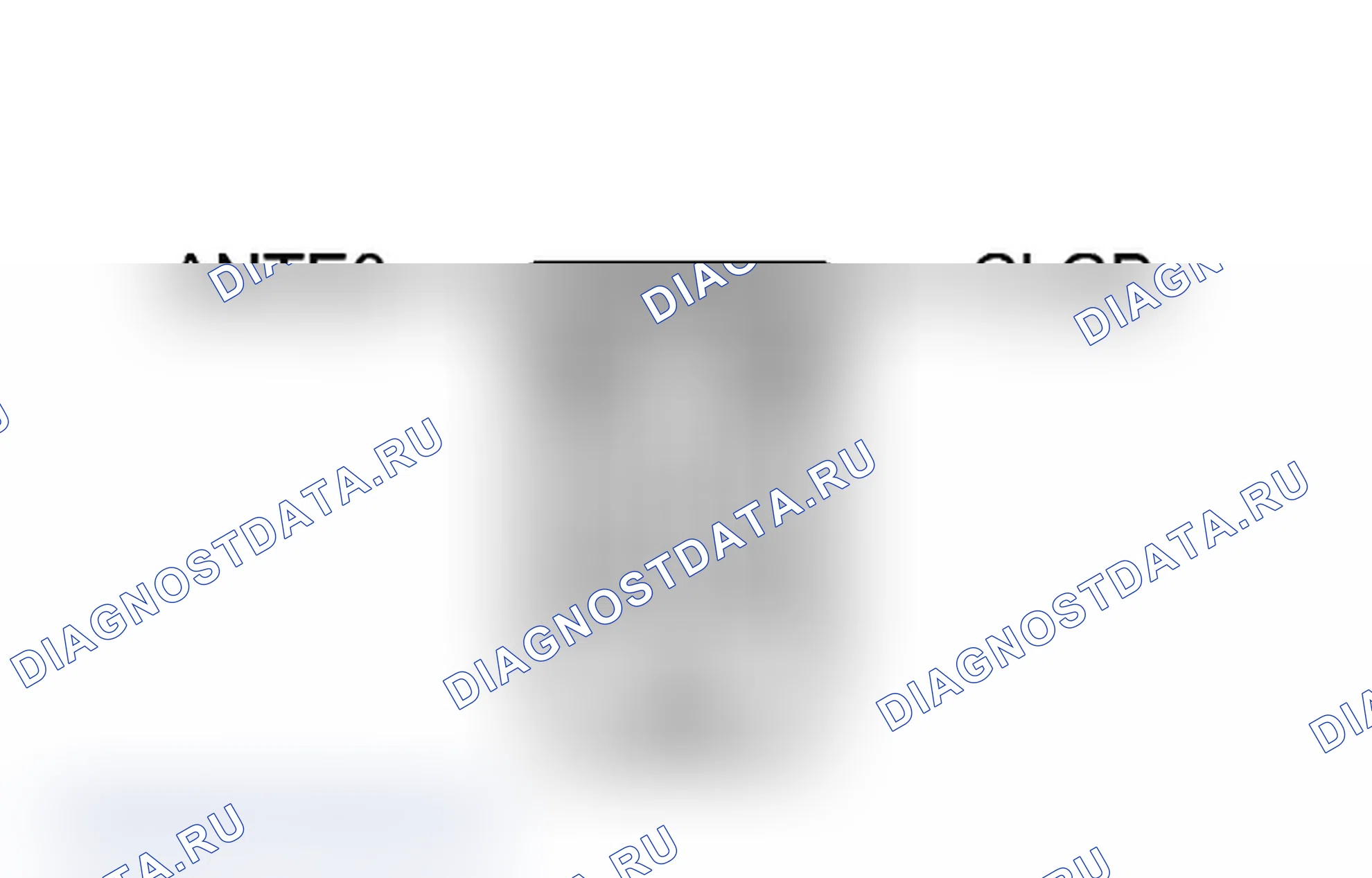 Рис. 170: ПОРЯДОК ВЫПОЛНЕНИЯ РАБОТ. Toyota Prius V I