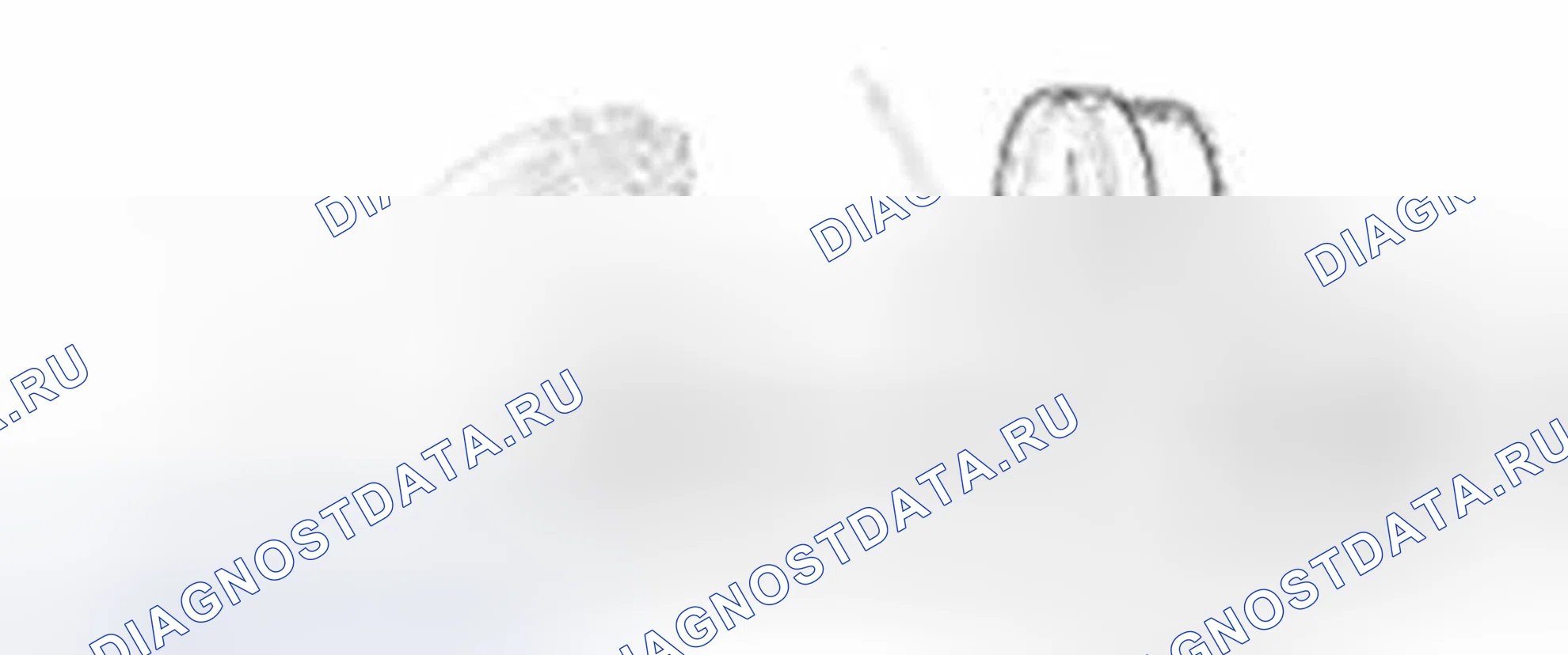 Рис. 52: Испытание крышки резервуара инвертора. Hyundai Sonata VI