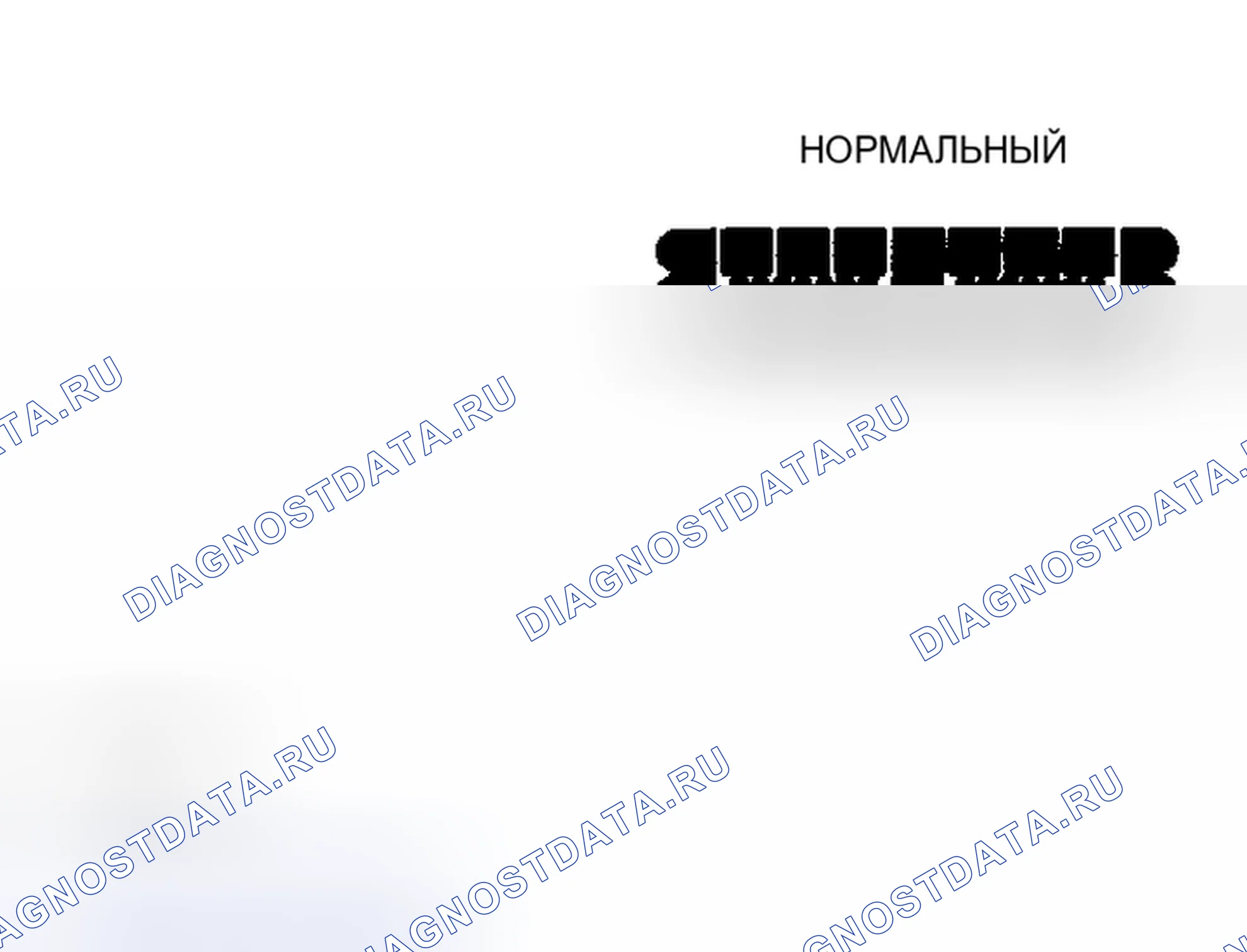 Рис. 5: Проверка состояния радиоприема. Mazda Tribute I рестайлинг