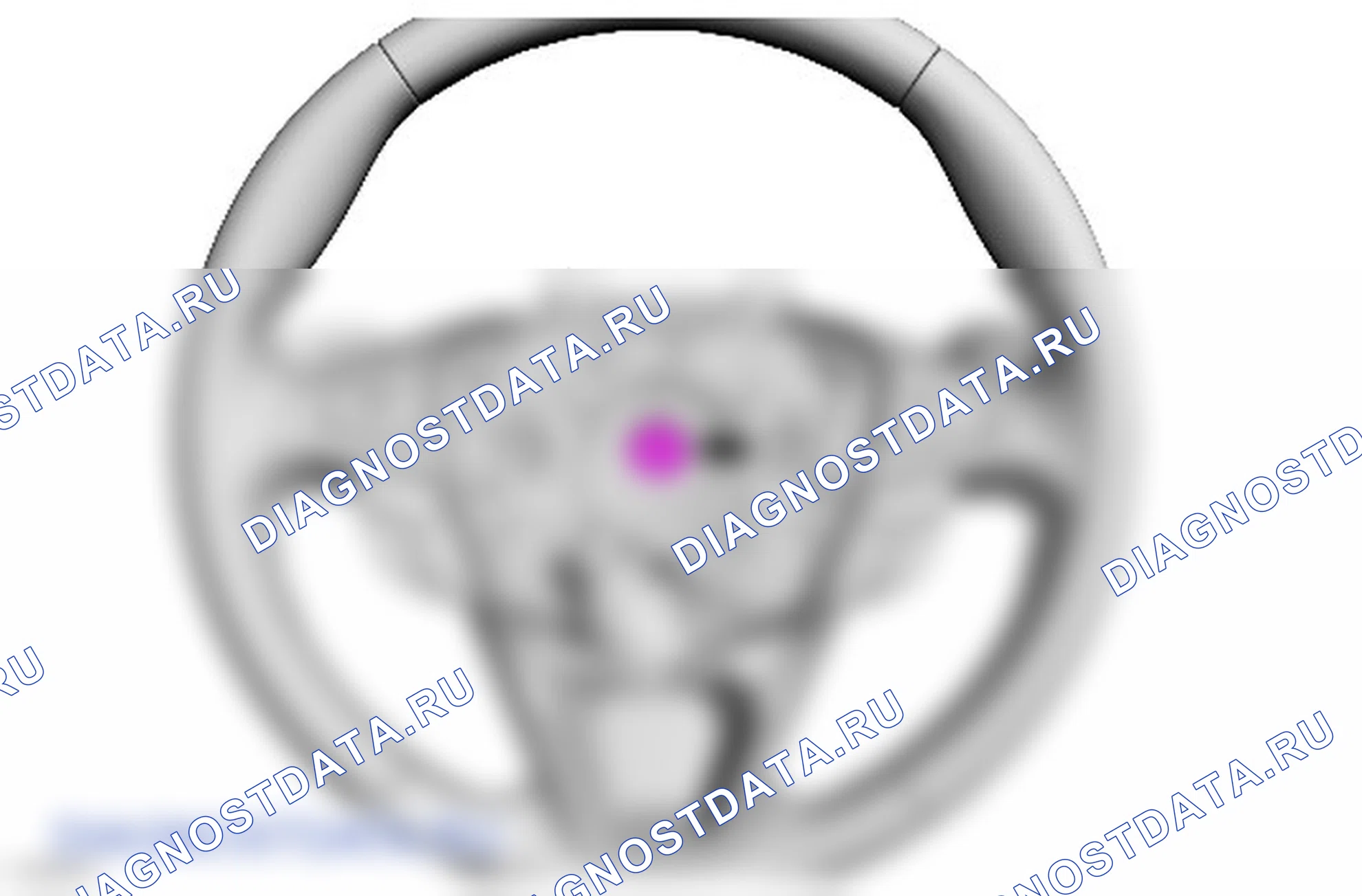 Как снять и установить рулевое колесо. Ford Galaxy III
