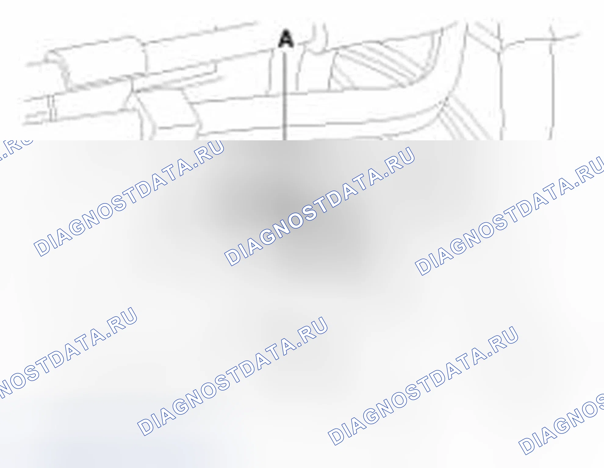 Рис. 113: Удаление. Hyundai Sonata VI