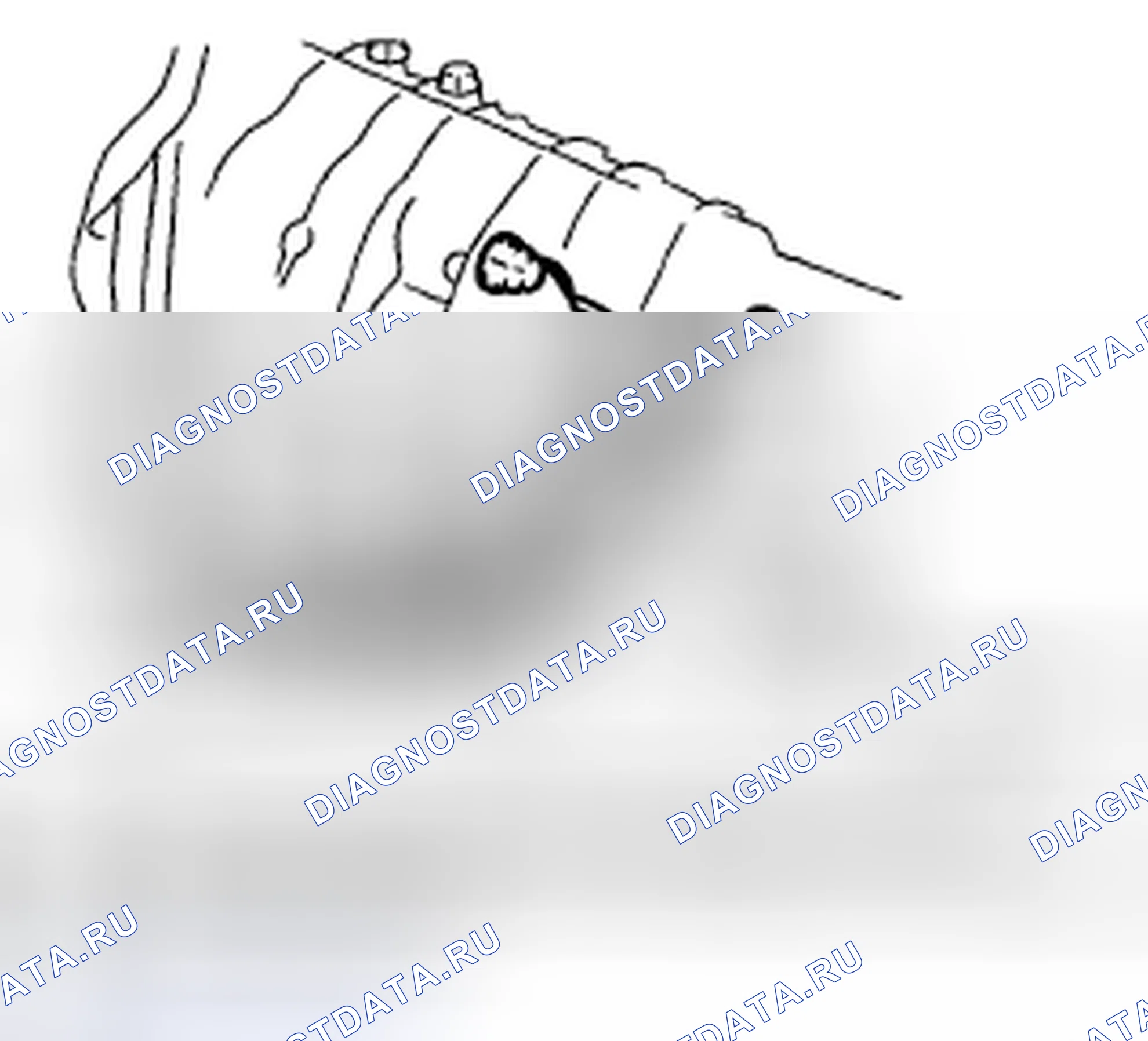 Рис. 67: ДЕМОНТАЖ. Subaru Legacy BL/BP рестайлинг