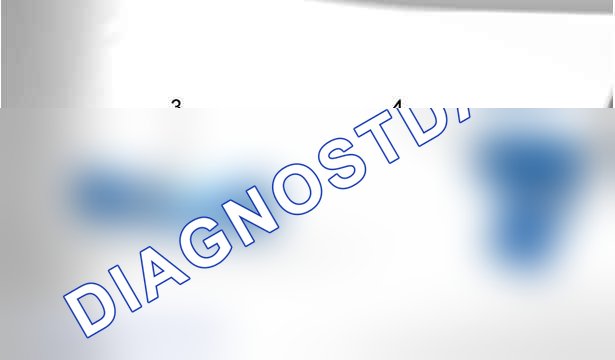 Разборка-сборка: заднего бампера — c5js0g2d. Citroen C-Elysee I
