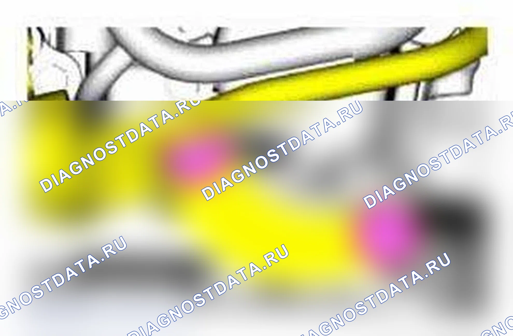 Рис. 338: Удаление. Ford Focus III