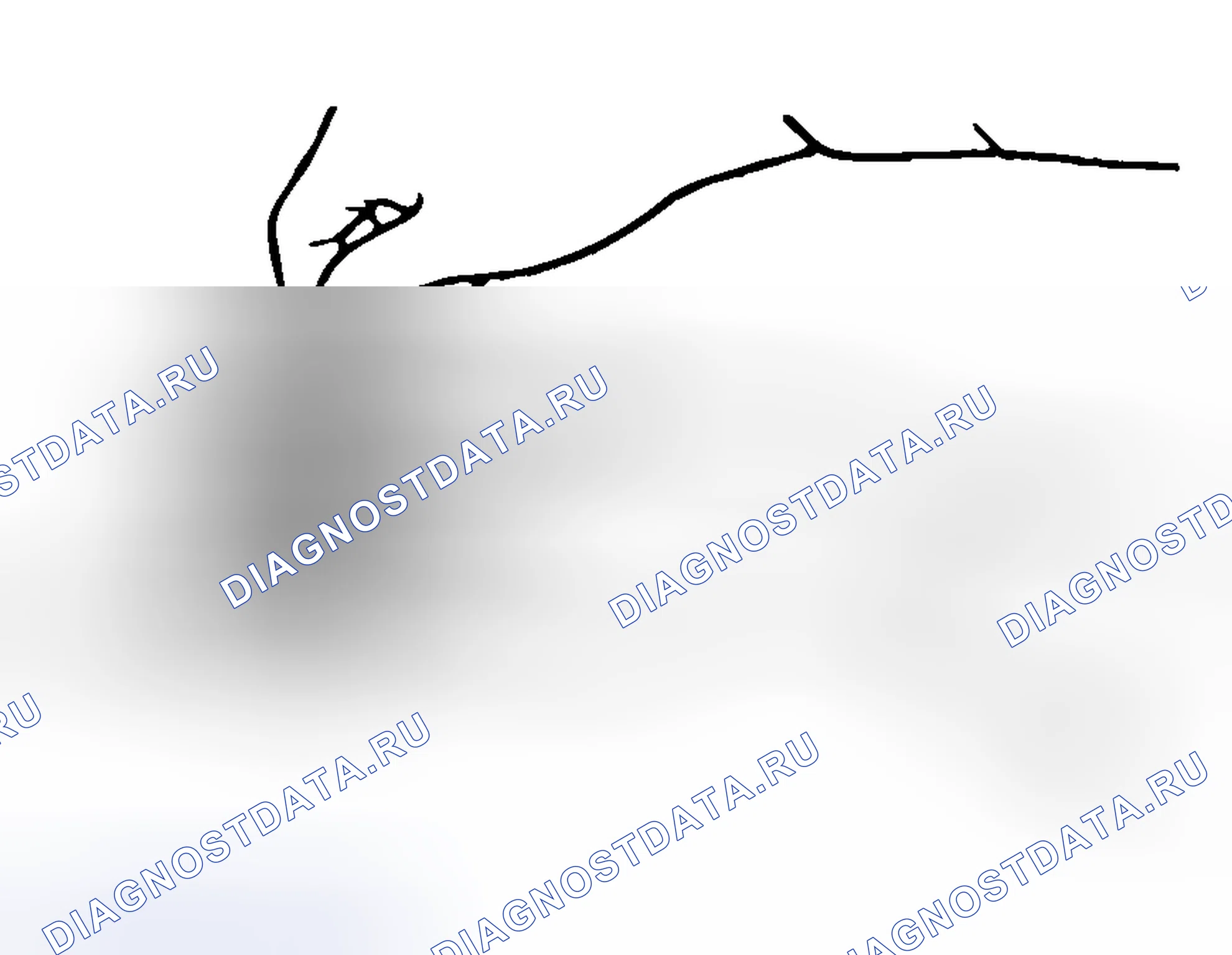 Рис. 183: > > F < < РЕГУЛИРОВКА ЗАЗОРА ДИФФЕРЕНЦИАЛА. Honda Grace I