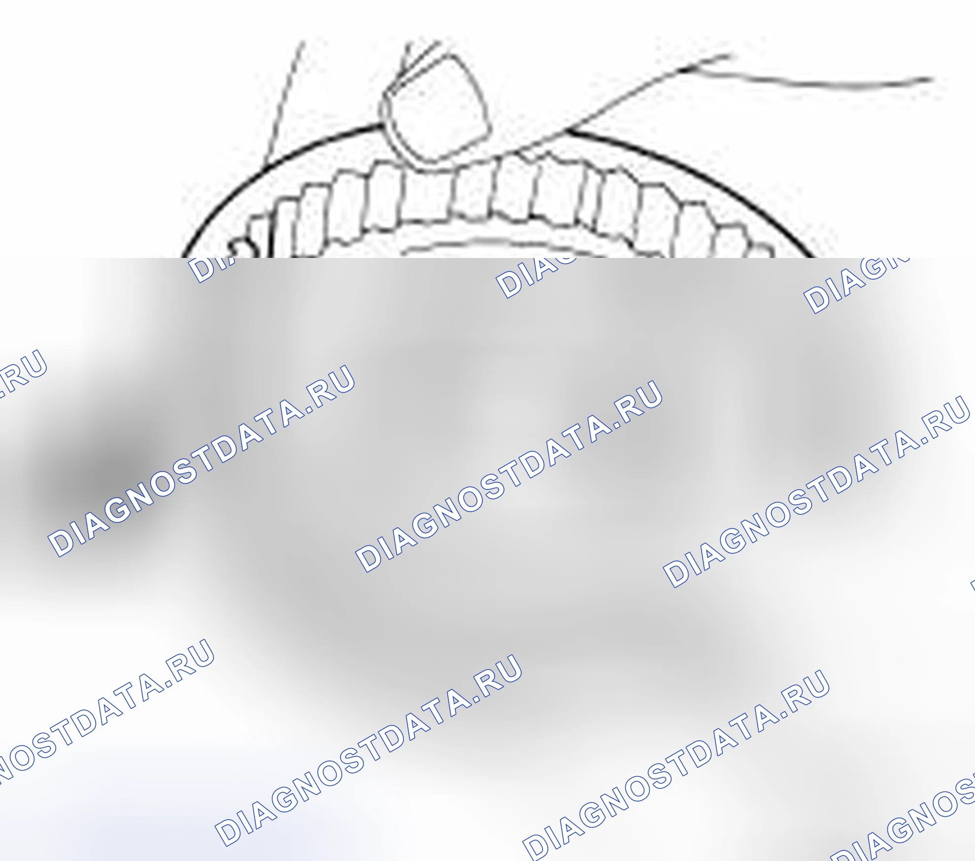 Рис. 138: Рукав. Honda Today I