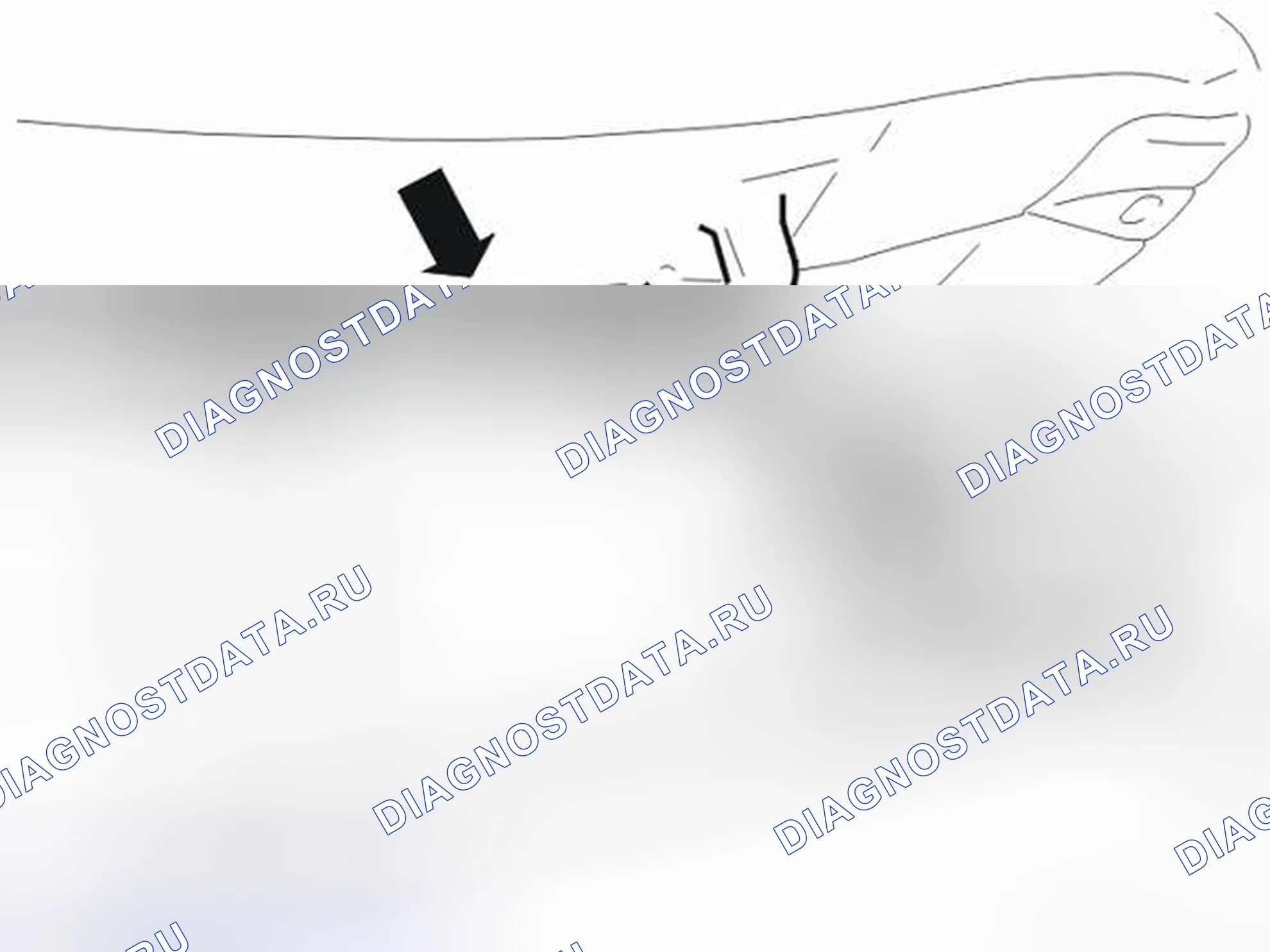 Рис. 73: ДЕМОНТАЖ ТОПЛИВНОГО БАКА. Volvo V50 I