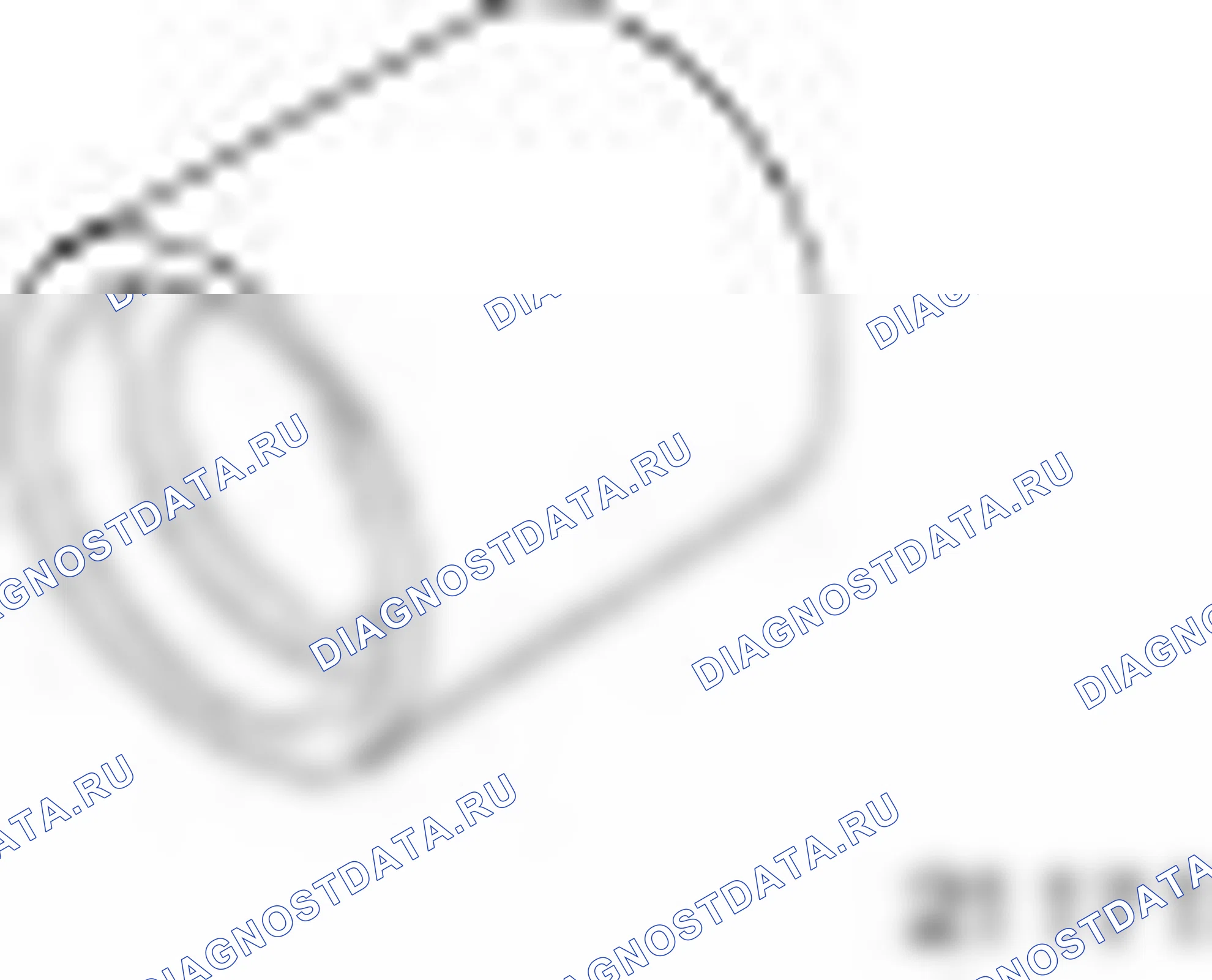 303-395 (21-171) — Опорный кронштейн для 303-435. Ford Transit Connect I