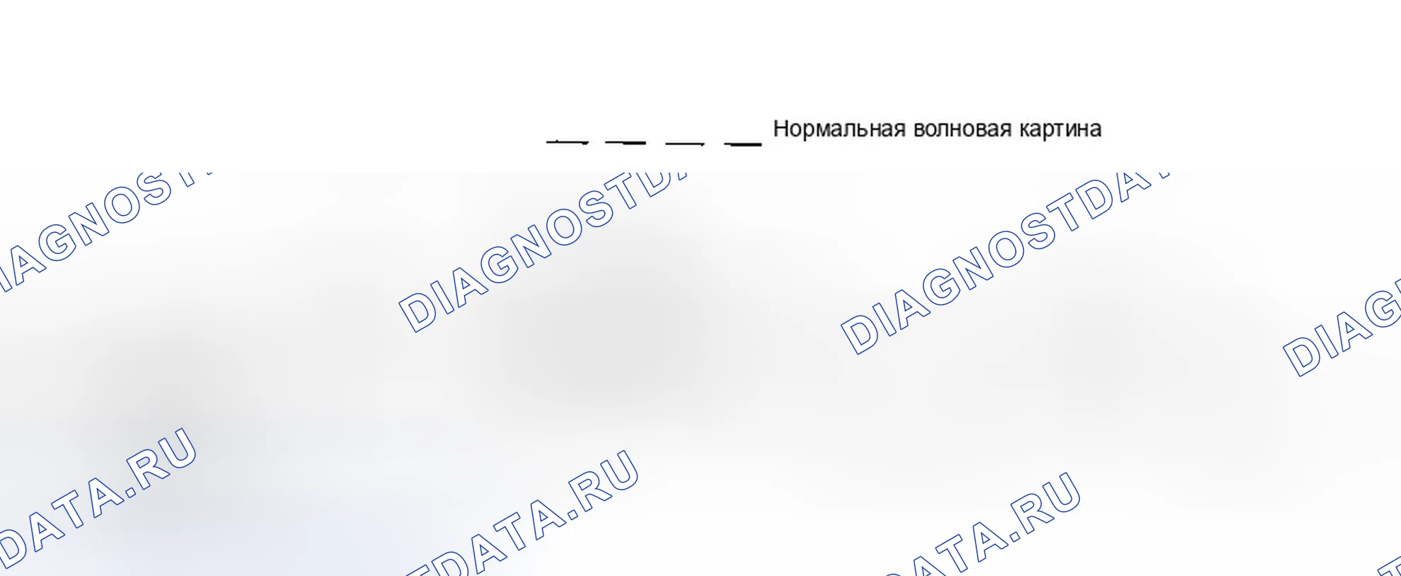 Рис. 40: КОДЫ 44, 52 и 53: КАТУШКИ ЗАЖИГАНИЯ. Dodge Stealth I