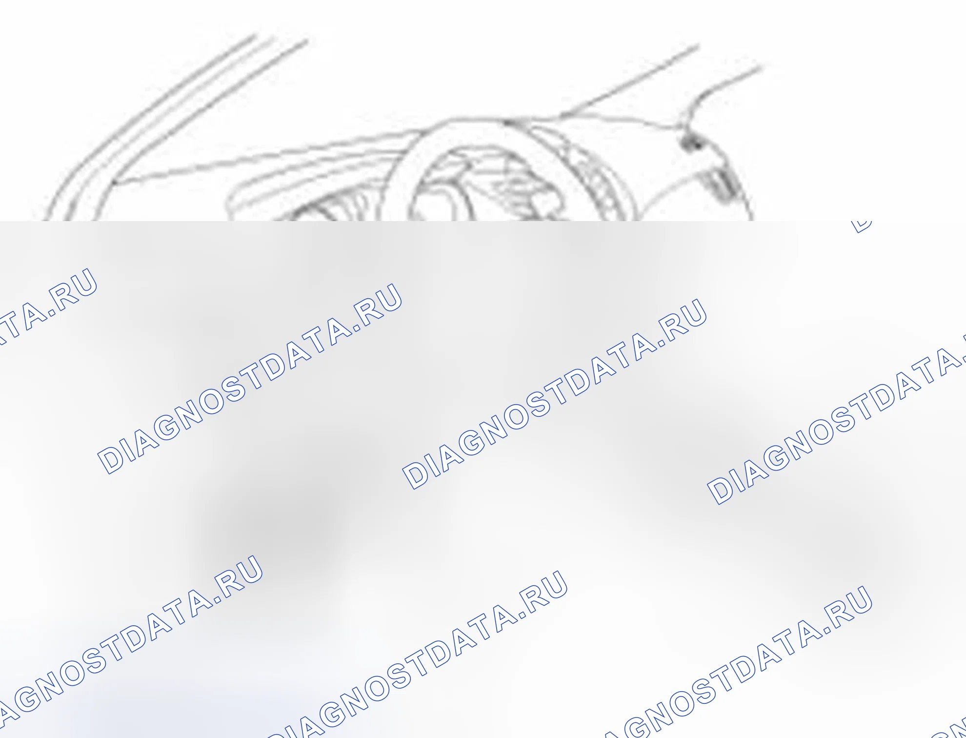 Рис. 67: Диагностика неисправностей при использовании GDS. Hyundai Elantra V