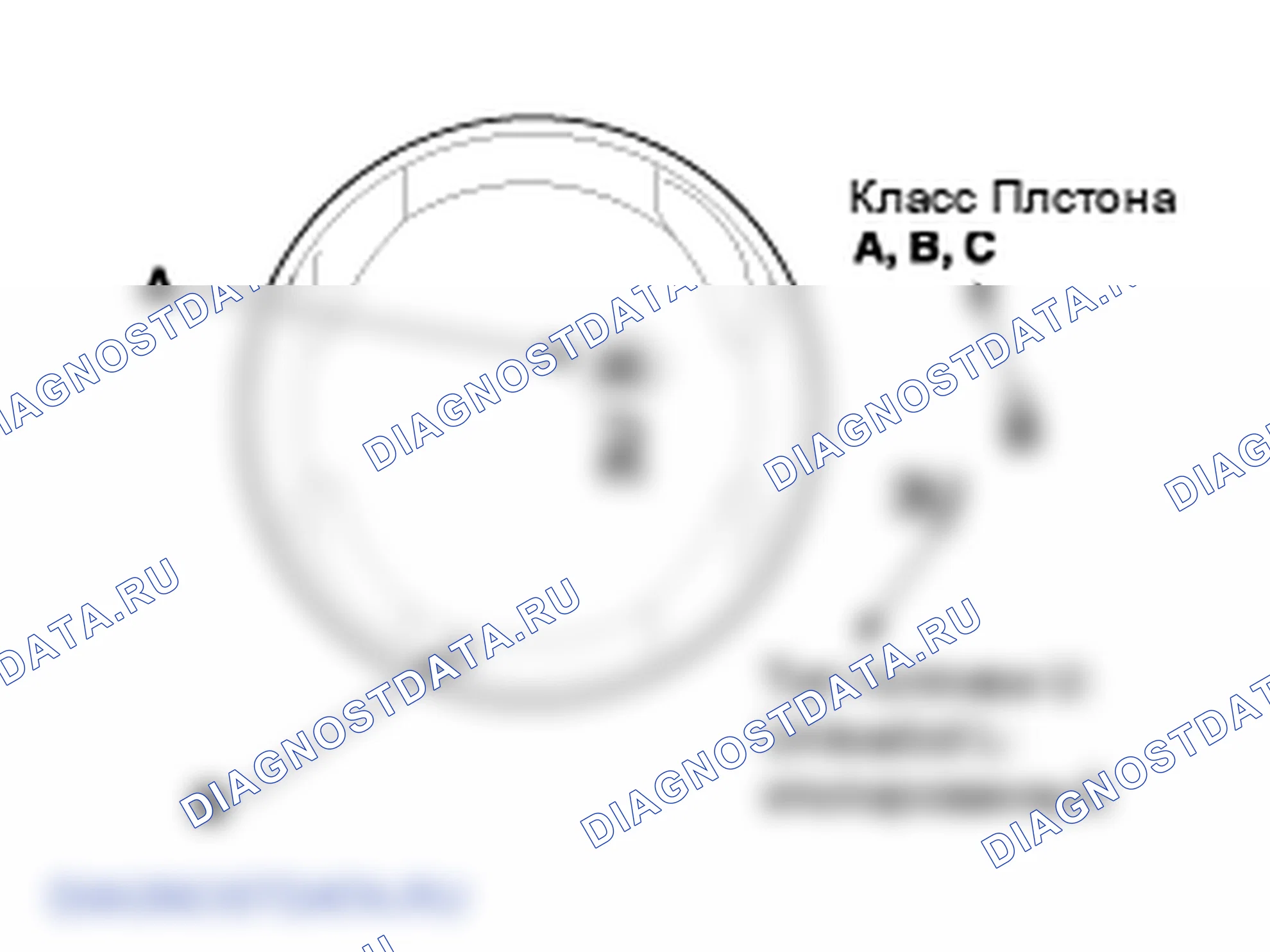 Проверка поршня и шатуна. Hyundai i20 GB