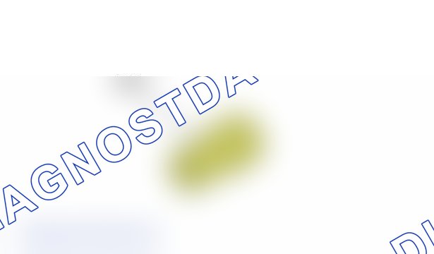 Повторная установка: двигателя DW12TED4 - DW12UTED — e5am0r0d. Peugeot 607 I рестайлинг