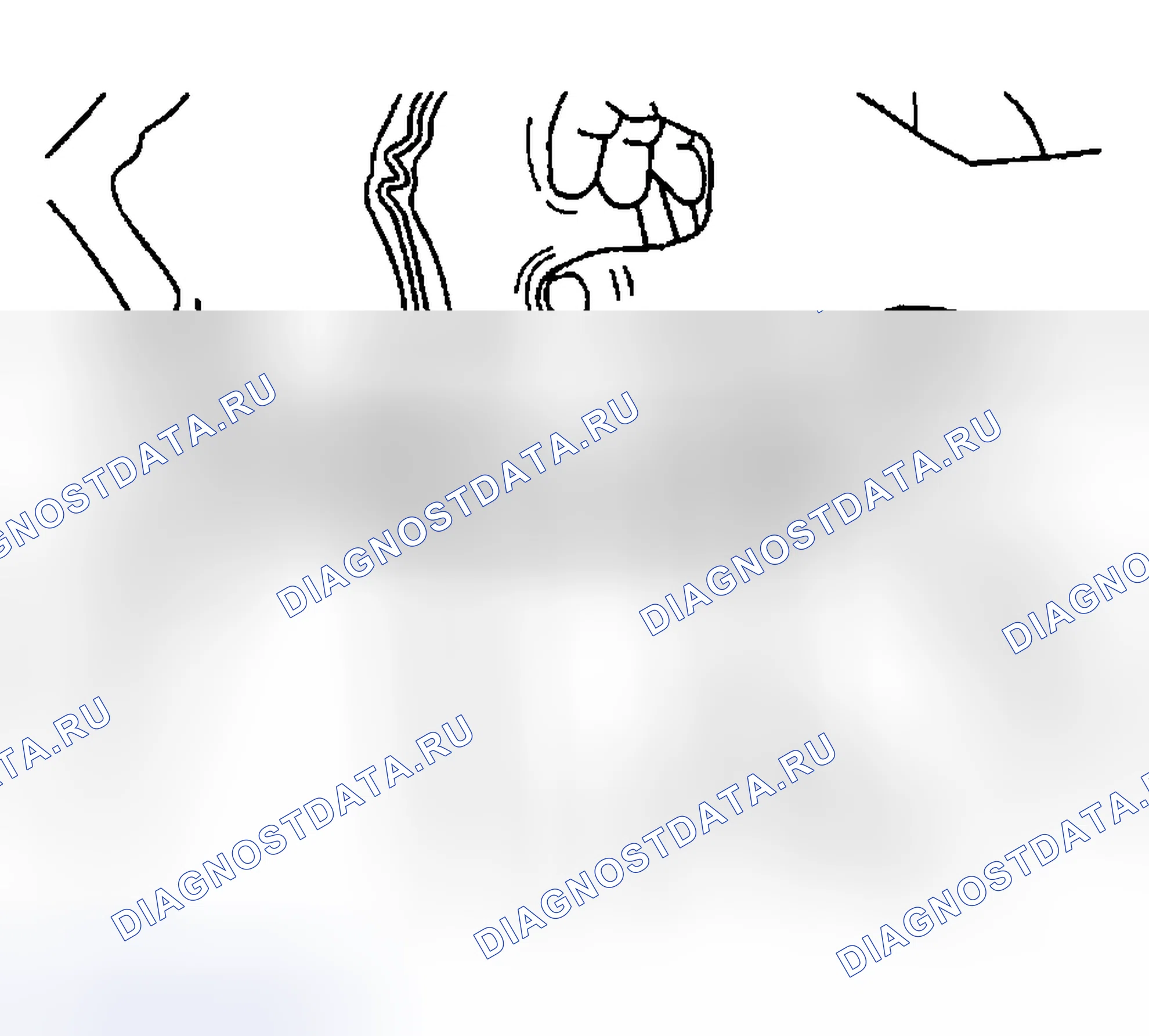 Рис. 92: Процедура установки. Hyundai Venue I