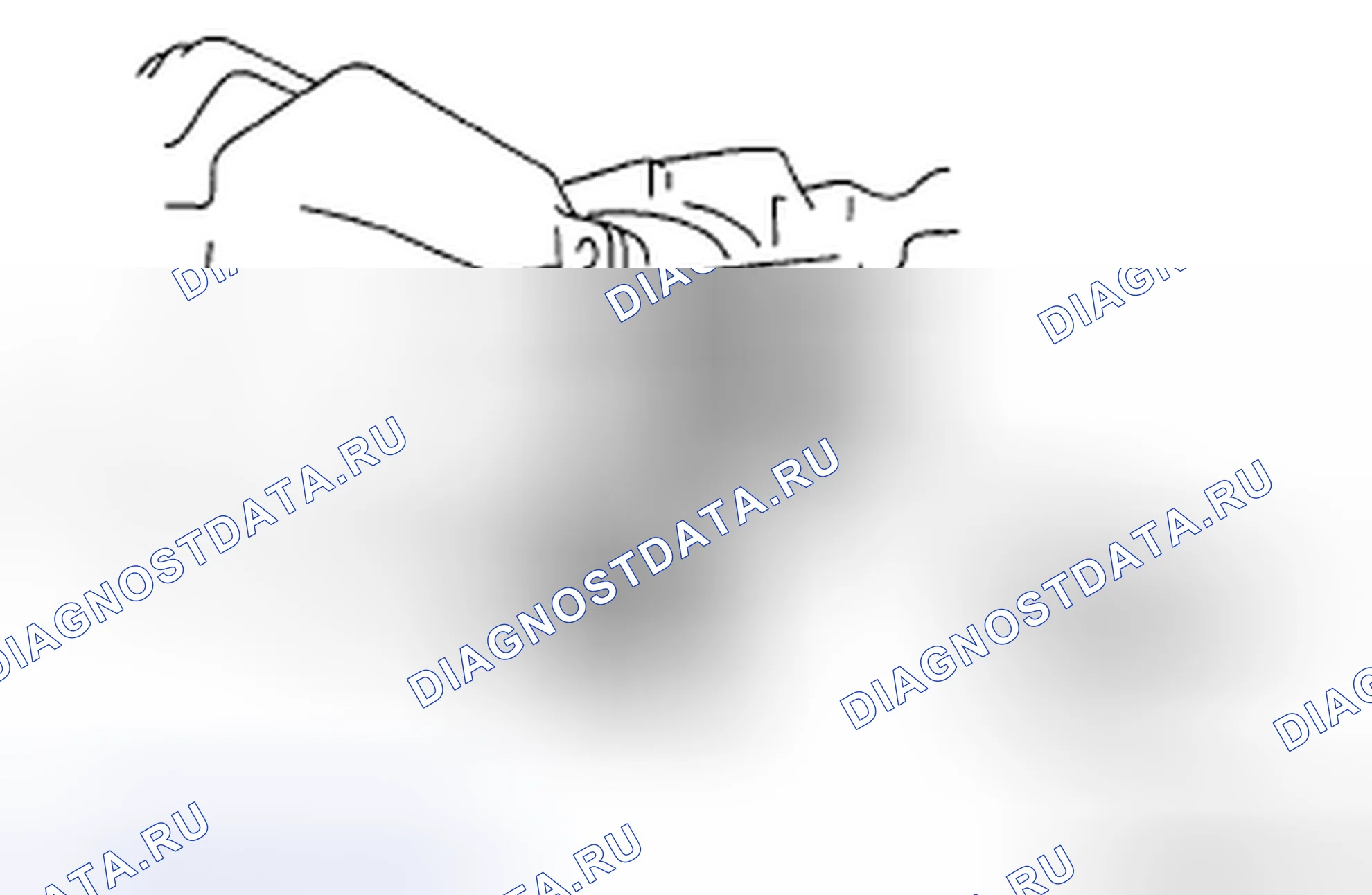Рис. 52: Примечание по демонтажу компонента муфты. Mazda CX-7 I