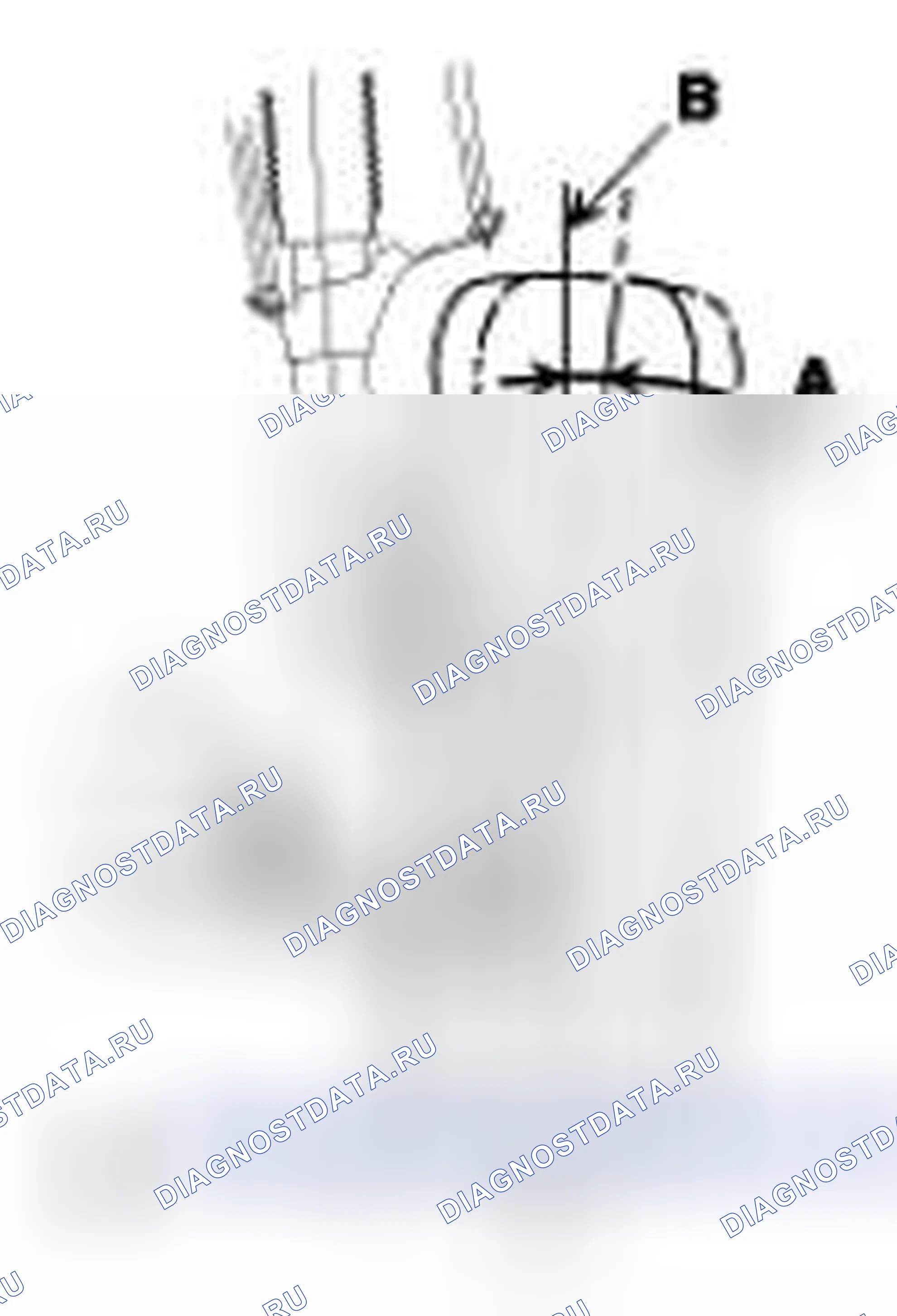 Рис. 9: Развал. Geely Panda I