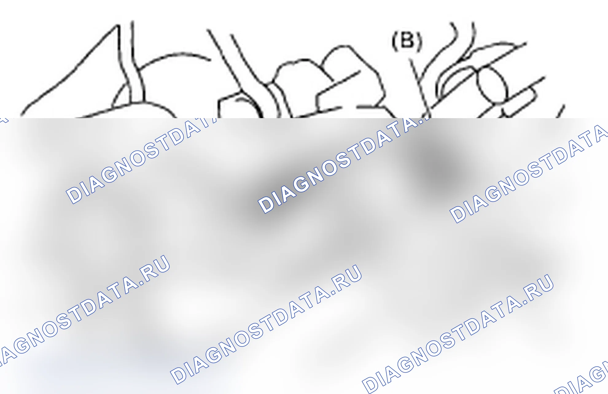 Рис. 525: ДЕМОНТАЖ. Subaru Impreza WRX GD/GG рестайлинг 2