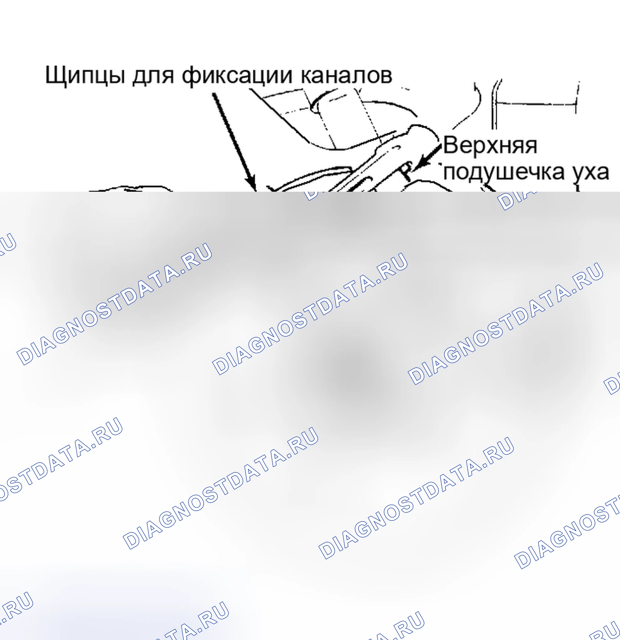 Рис. 15: Клинчинг наружных ушей. Pontiac Sunbird II
