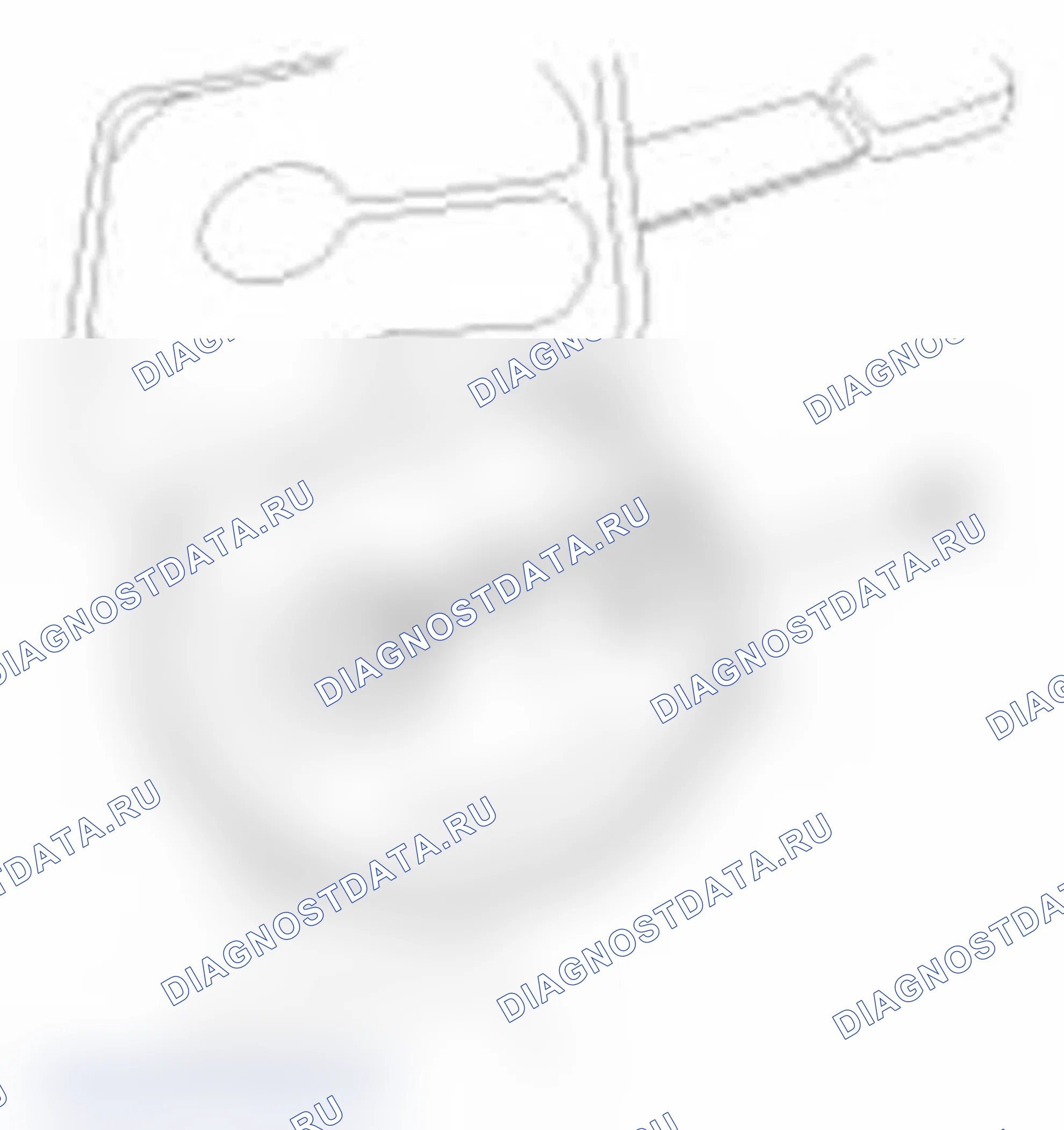 Рис. 9. Hyundai Santa Fe II рестайлинг