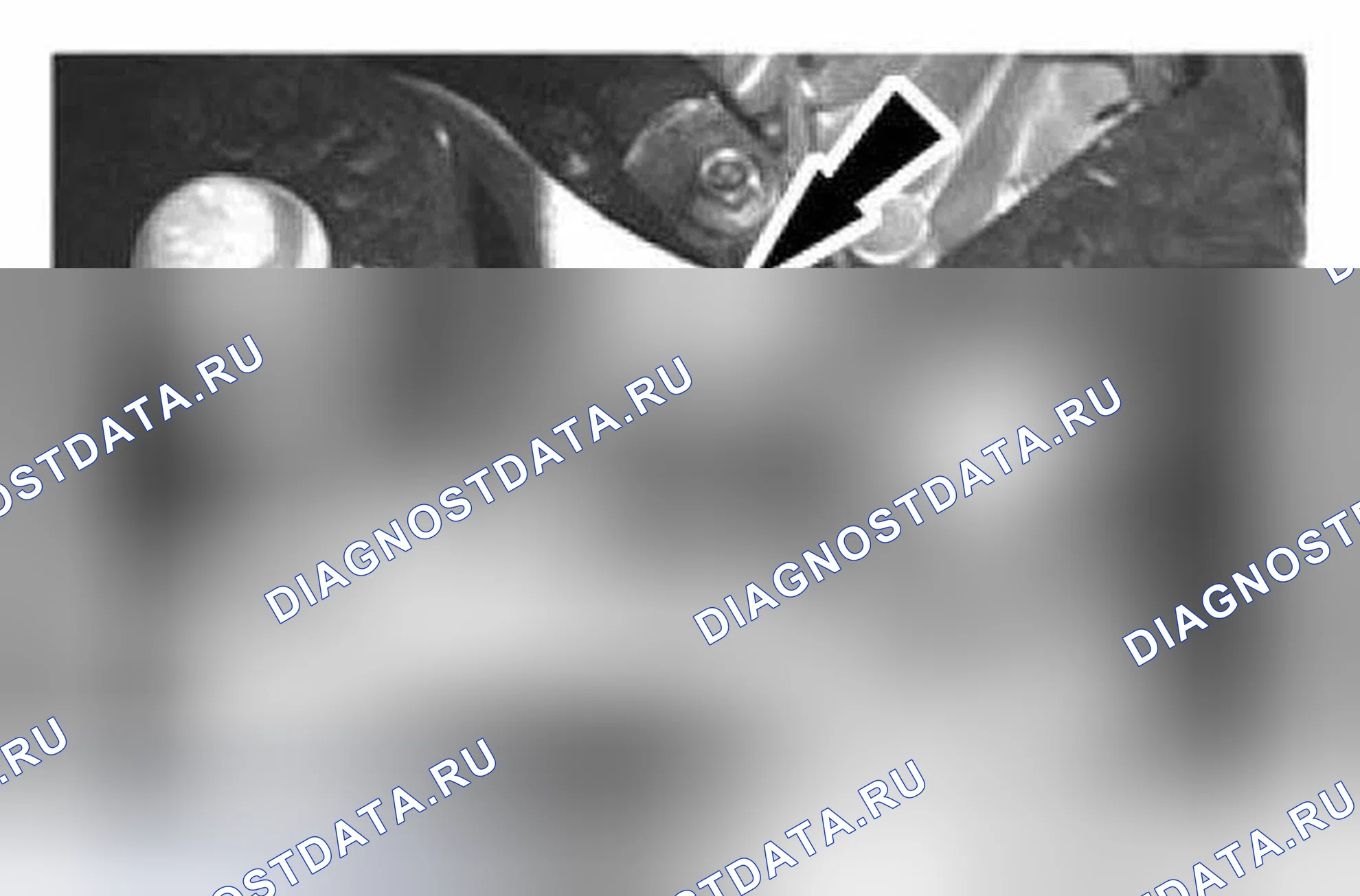 Рис. 193. Ford Fiesta Mk6