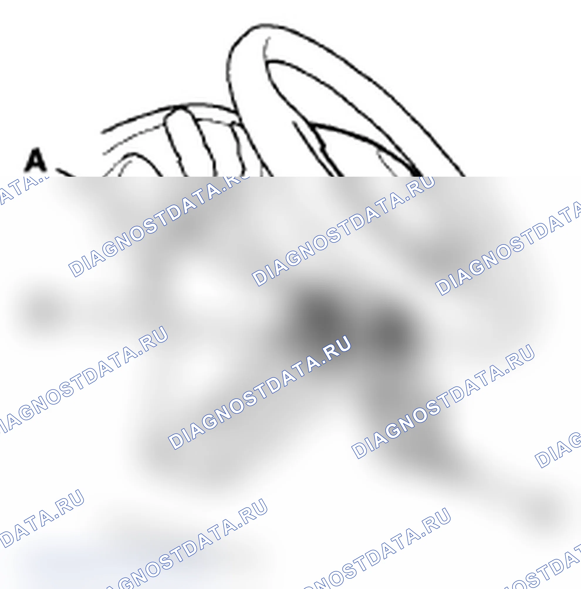 Рис. 216. Acura TL IV рестайлинг