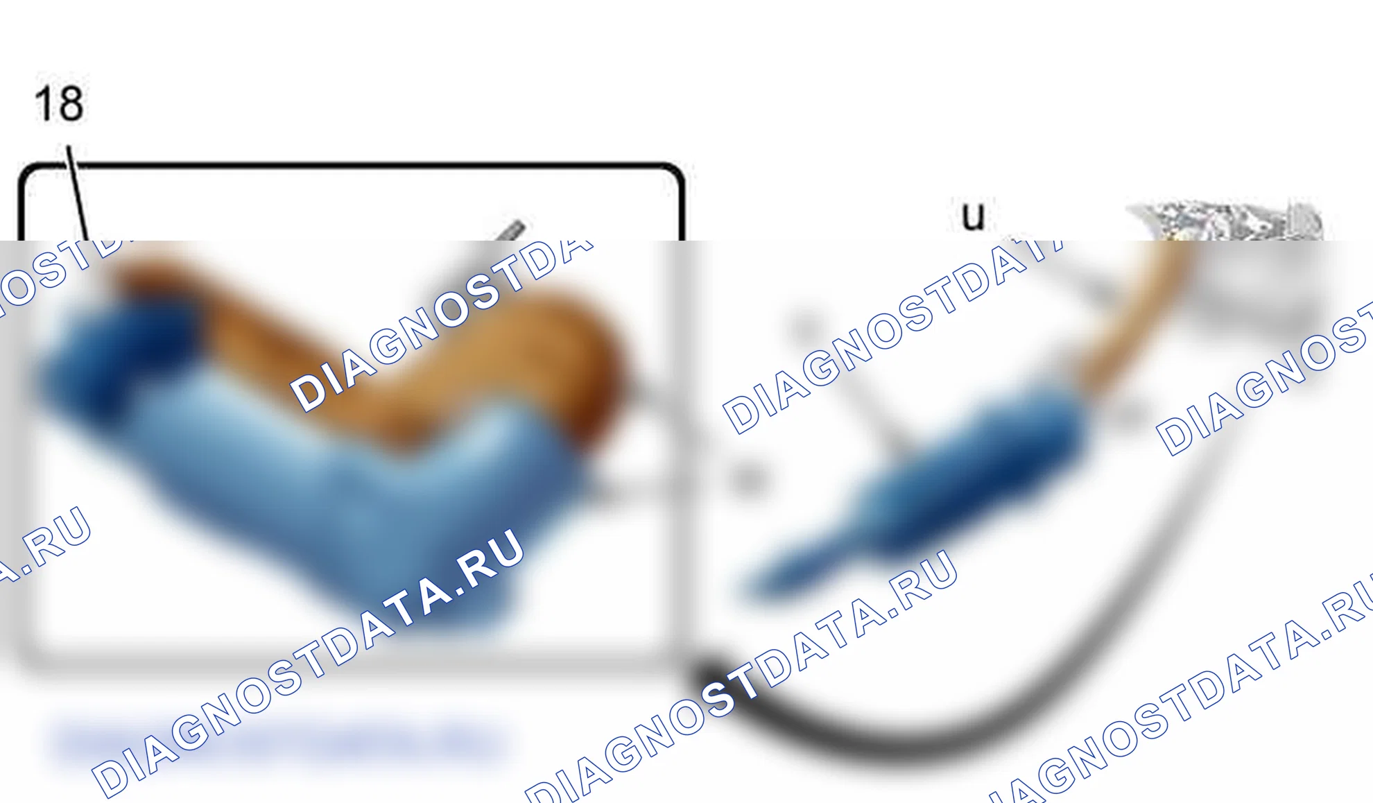 Функция: система питания воздухом (DELPHI dcm 3.4) — b1jp0dgd. Citroen C4 I