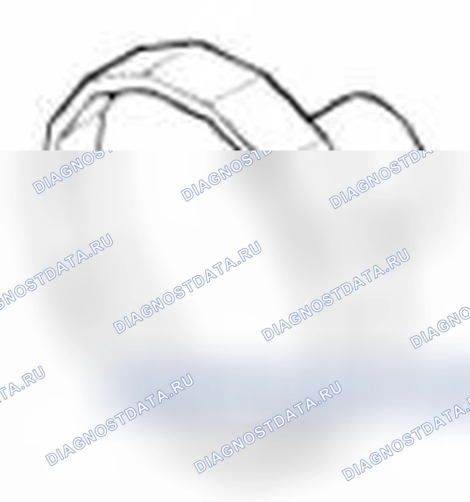Рис. 34. Hyundai Veloster I