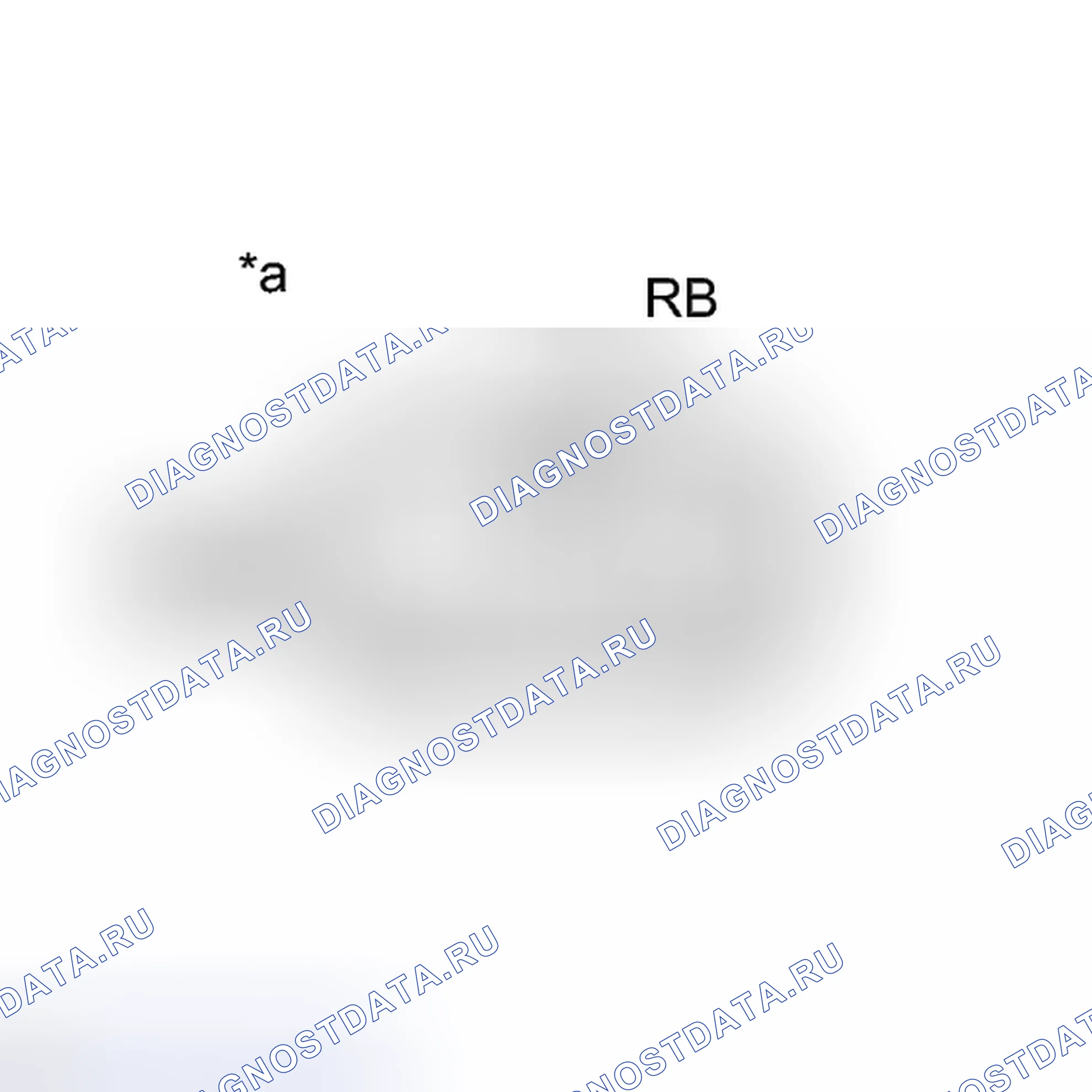 Рис. 845: ПОРЯДОК ВЫПОЛНЕНИЯ РАБОТ. Toyota Camry XV50