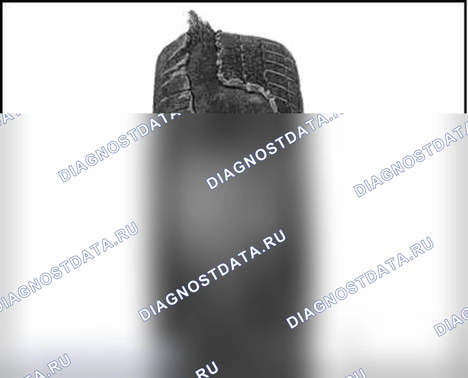Рис. 27: ДЕЗИНТЕГРИРОВАННЫЙ ПРОТЕКТОР. Audi TT 8J рестайлинг
