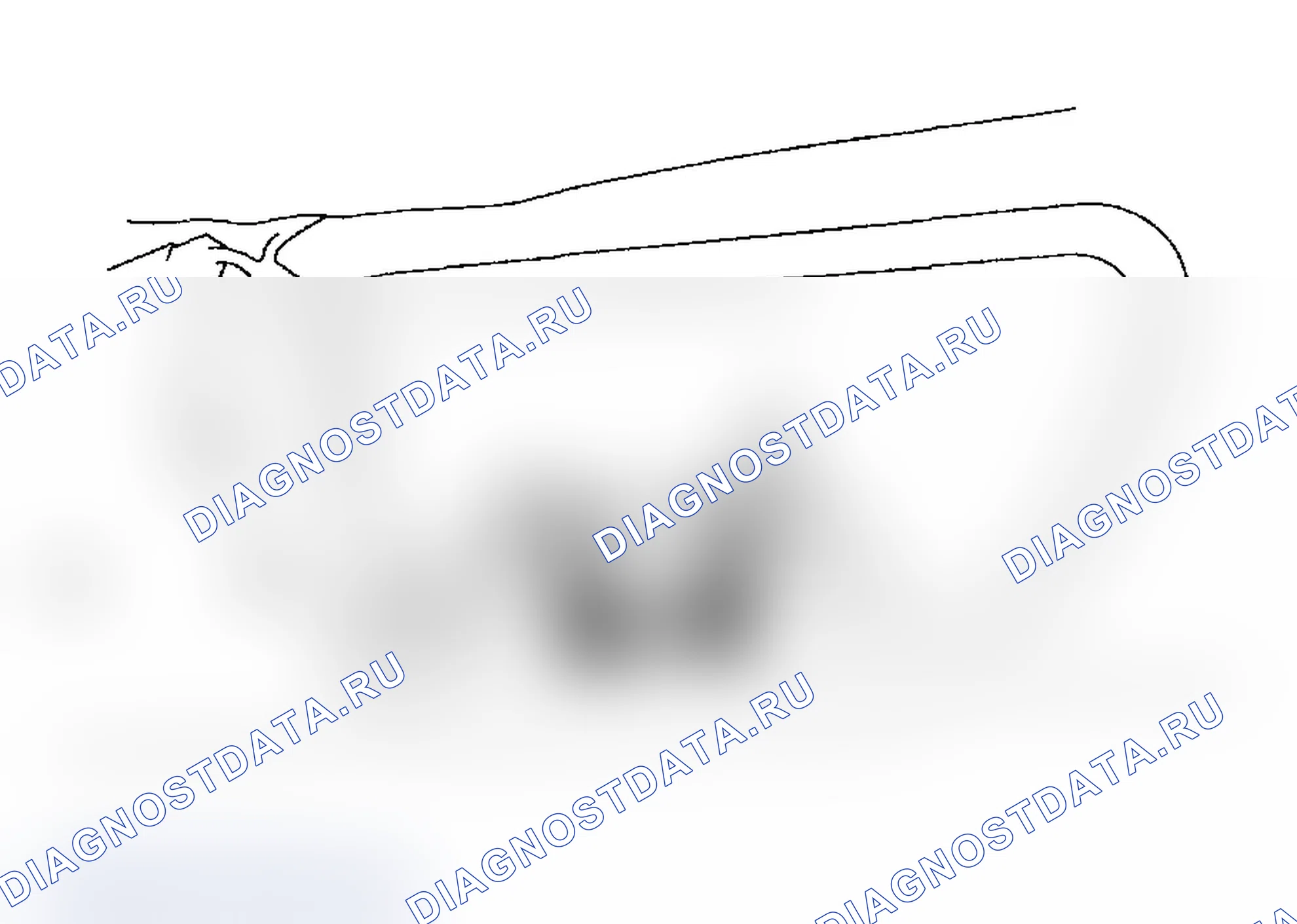 Рис. 45: ДЕМОНТАЖ. Subaru Impreza WRX GD/GG рестайлинг