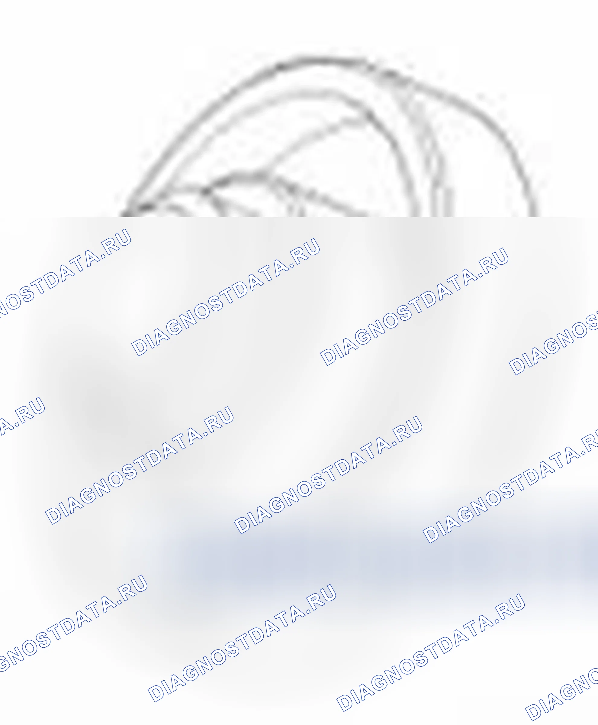 Рис. 112. Hyundai Elantra V