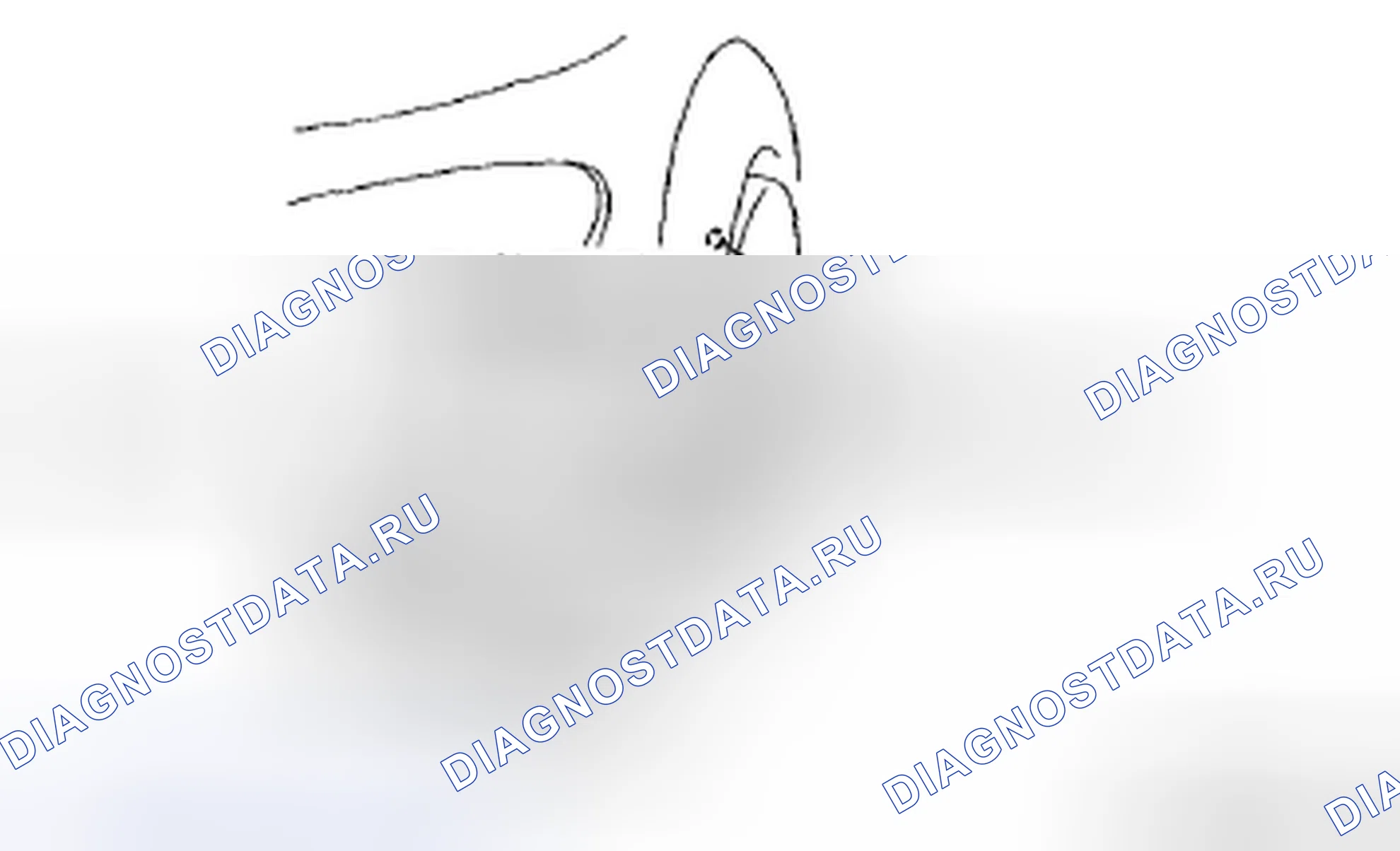 Рис. 3: СНЯТИЕ / УСТАНОВКА ЛАМПОЧКИ ПАРКОВКИ / ПЕРЕДНЕГО ПОВОРОТА. Mazda MX-5 NC рестайлинг