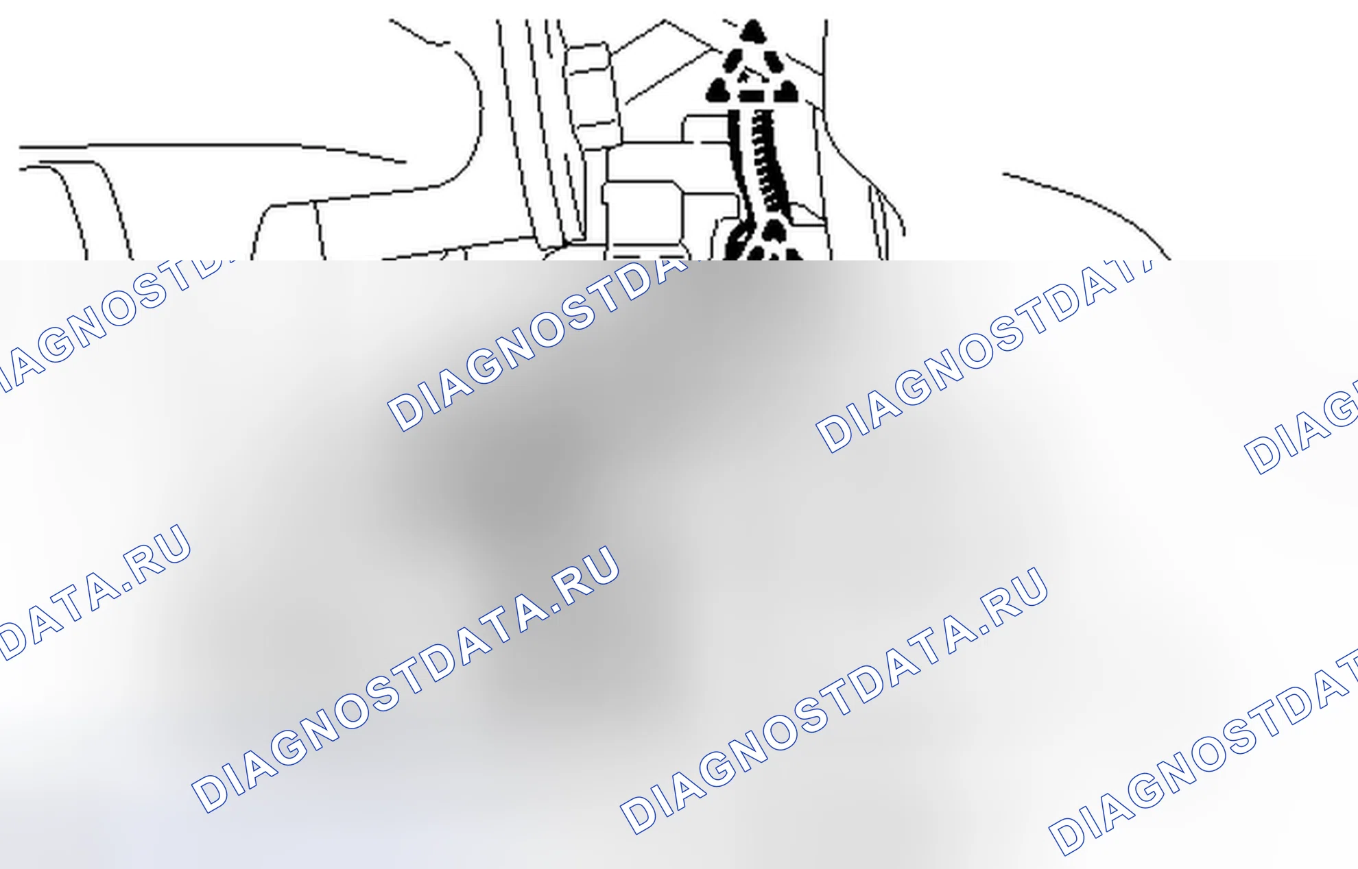 Рис. 177: ДЕМОНТАЖ. Toyota Tundra II