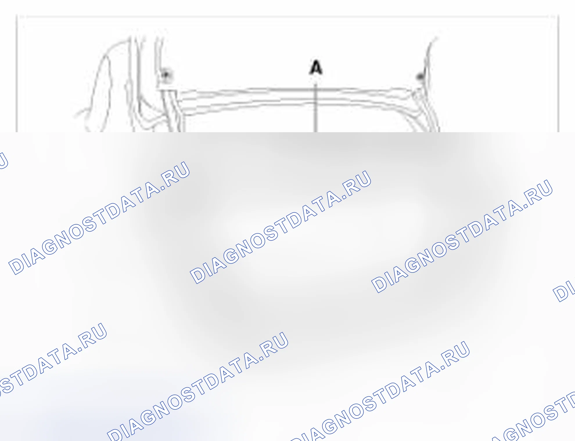 Рис. 32: Замена крышки багажника. BMW 6 серия F06/F13/F12