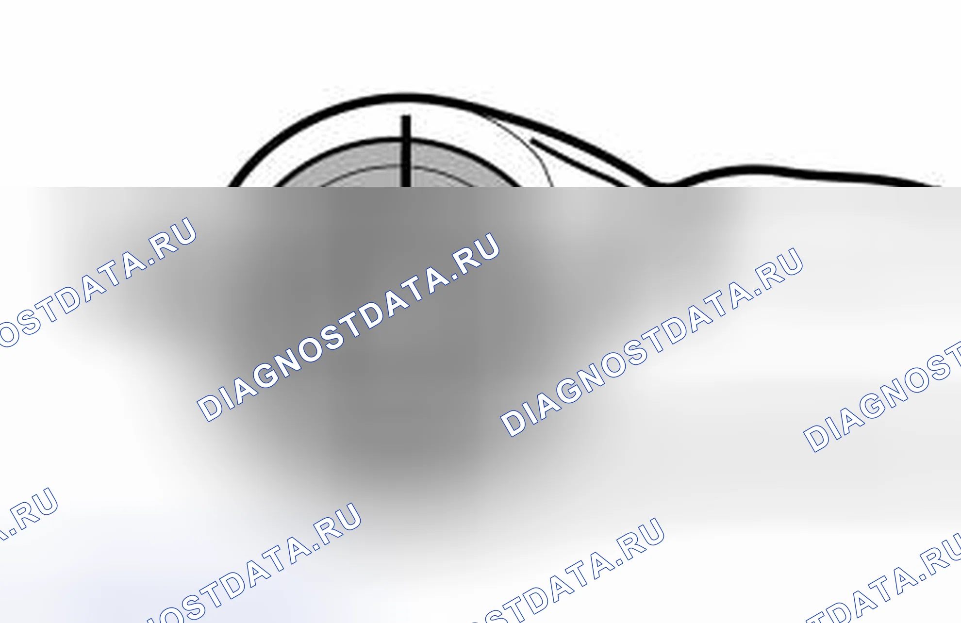 Рис. 45: Установка передней втулки. Volvo S80 I рестайлинг