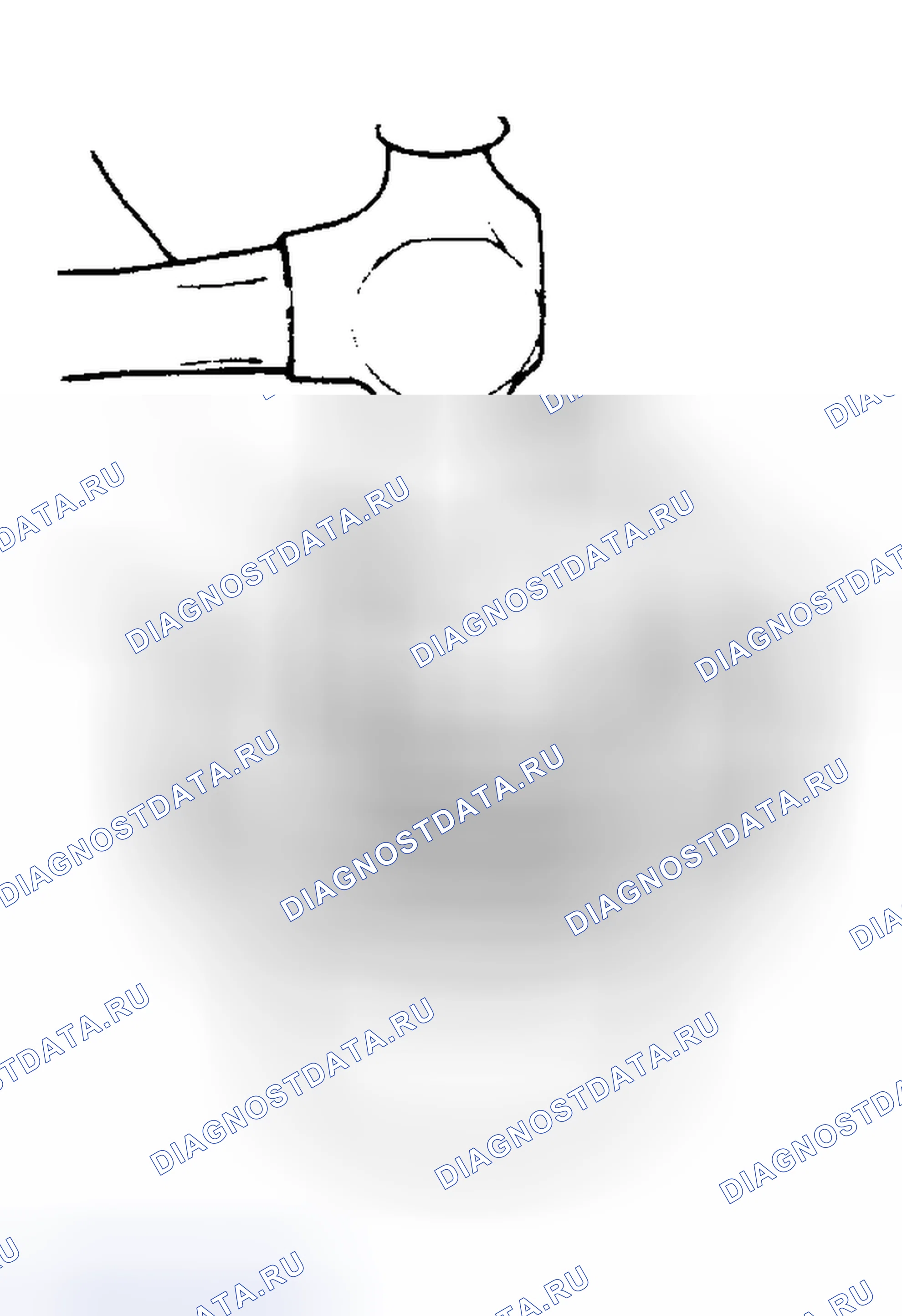 Рис. 99: Подшипник стойки - Инструмент № 17-Support Блок, № 19-Staking Инструмент. Buick Electra V