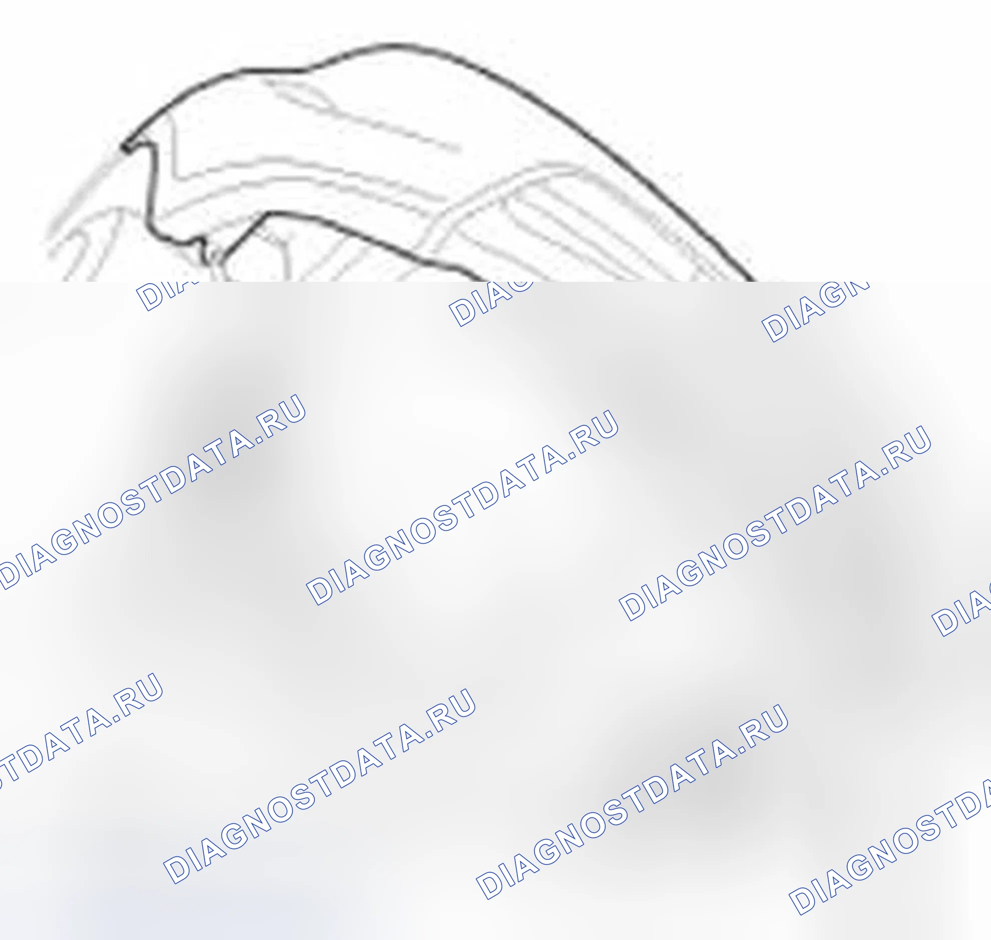 Рис. 12. Hyundai Veloster I