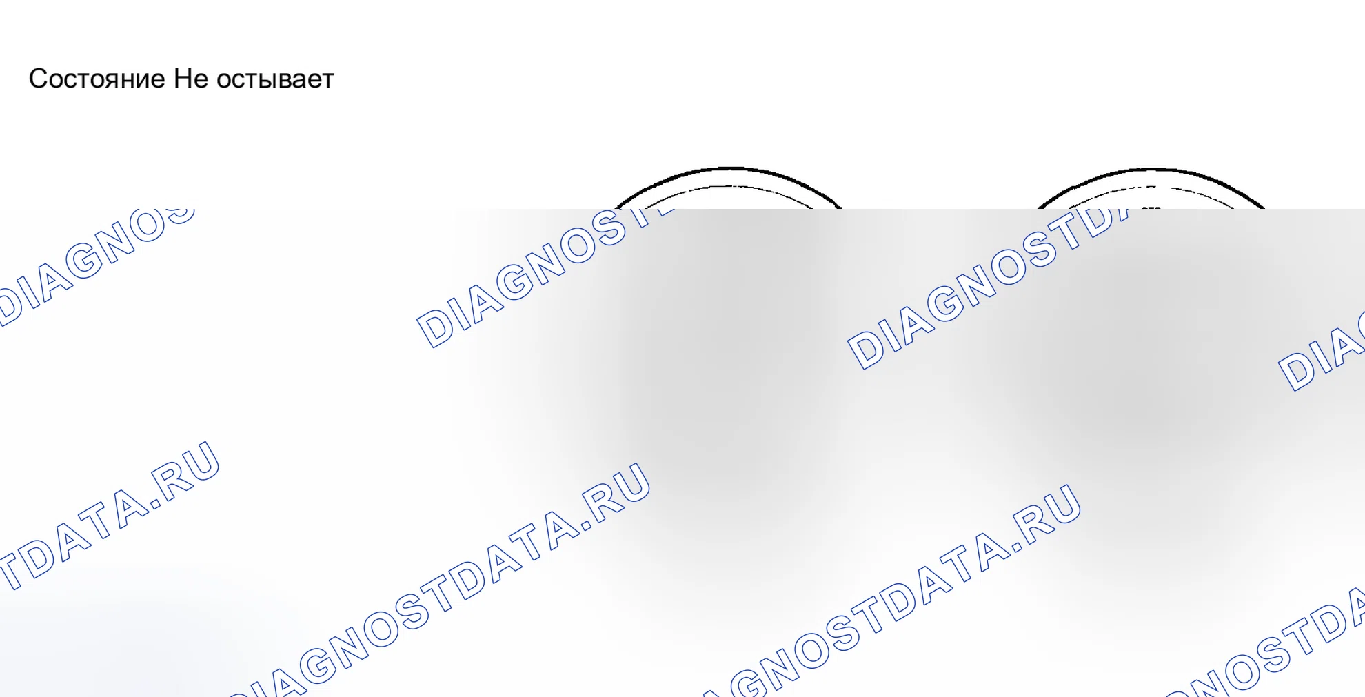 Рис. 64. Hyundai Elantra III рестайлинг