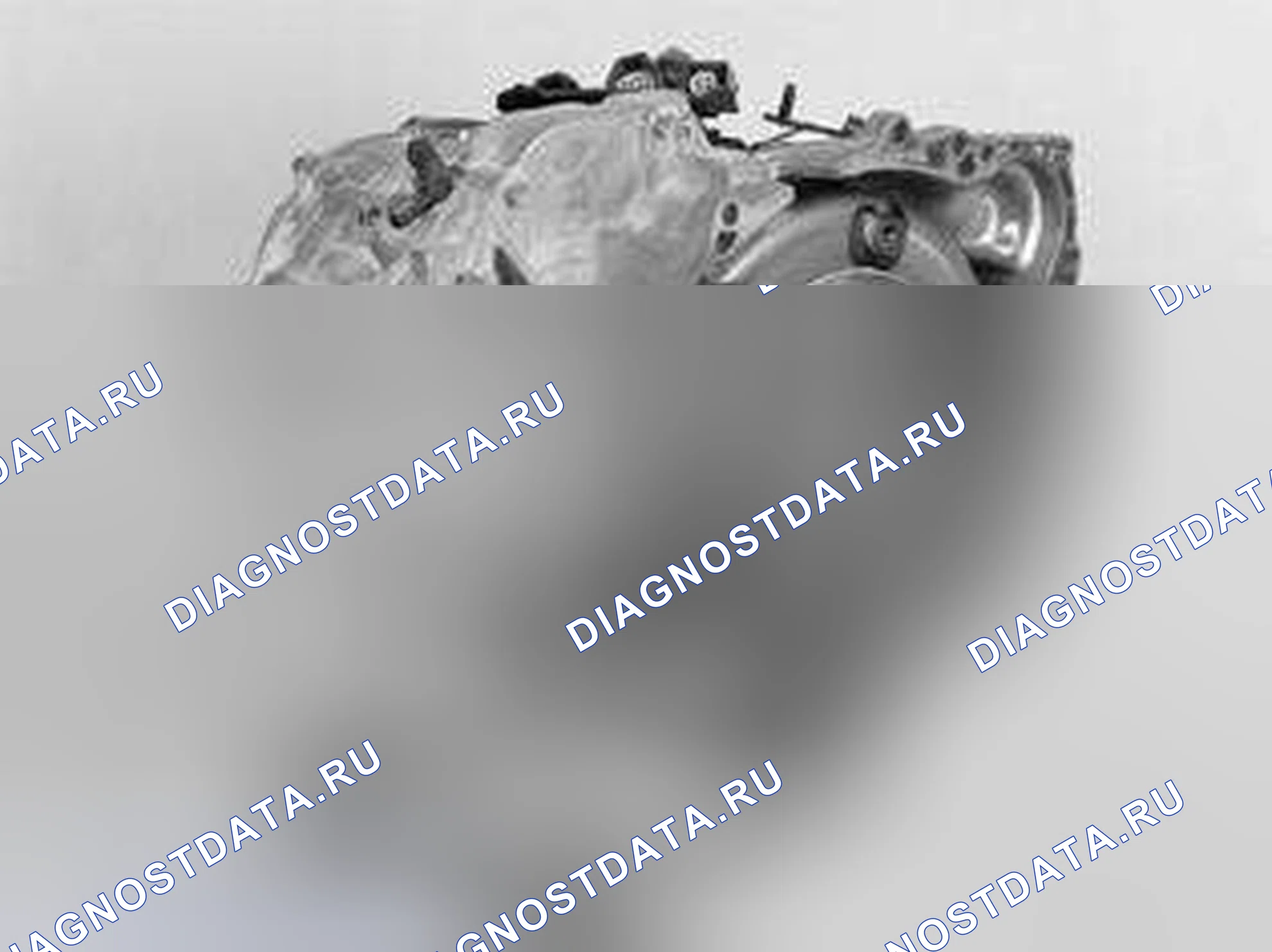 Рис. 490: Проверка и передача компонентов на коробке передач. Volvo V70 II