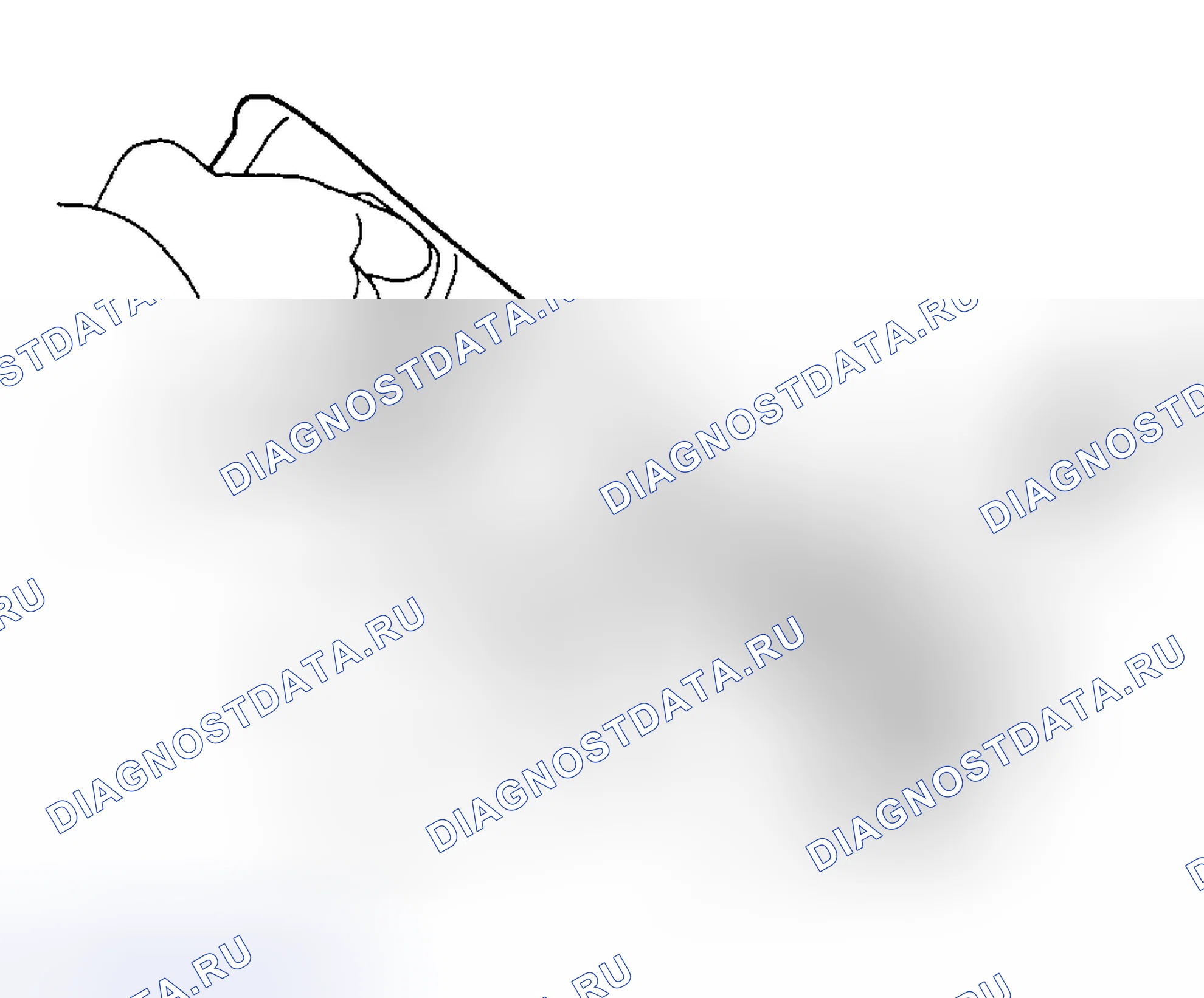 Рис. 9: Разборка. Lexus ES V20