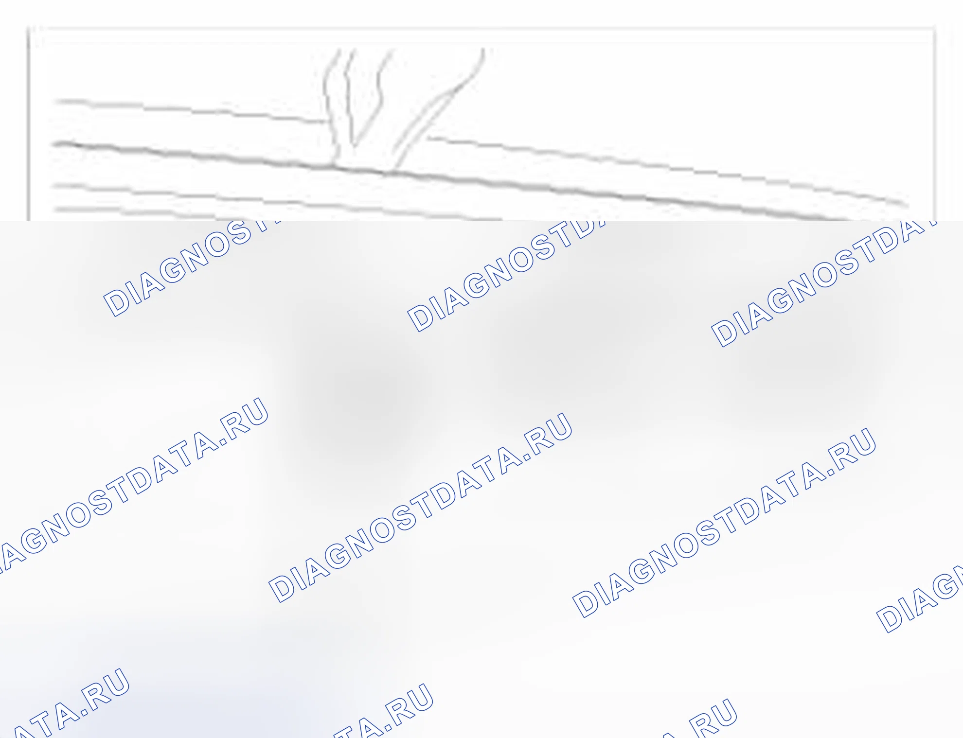 Рис. 10: Демонтаж. BMW 6 серия F06/F13/F12