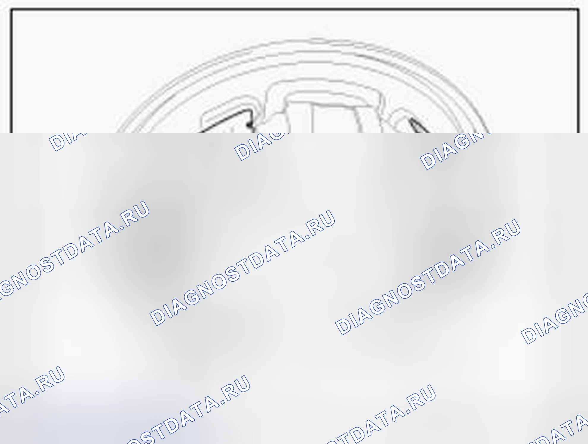 Рис. 59. Hyundai Accent IV