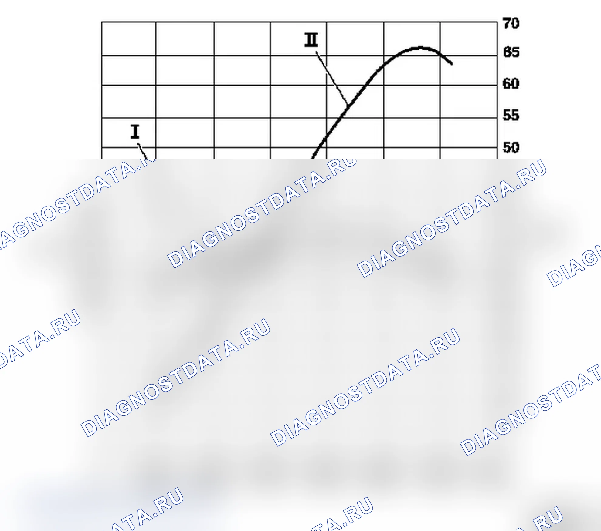 Бензиновый двигатель Z 14 XEP DOHC-0. Opel Corsa C