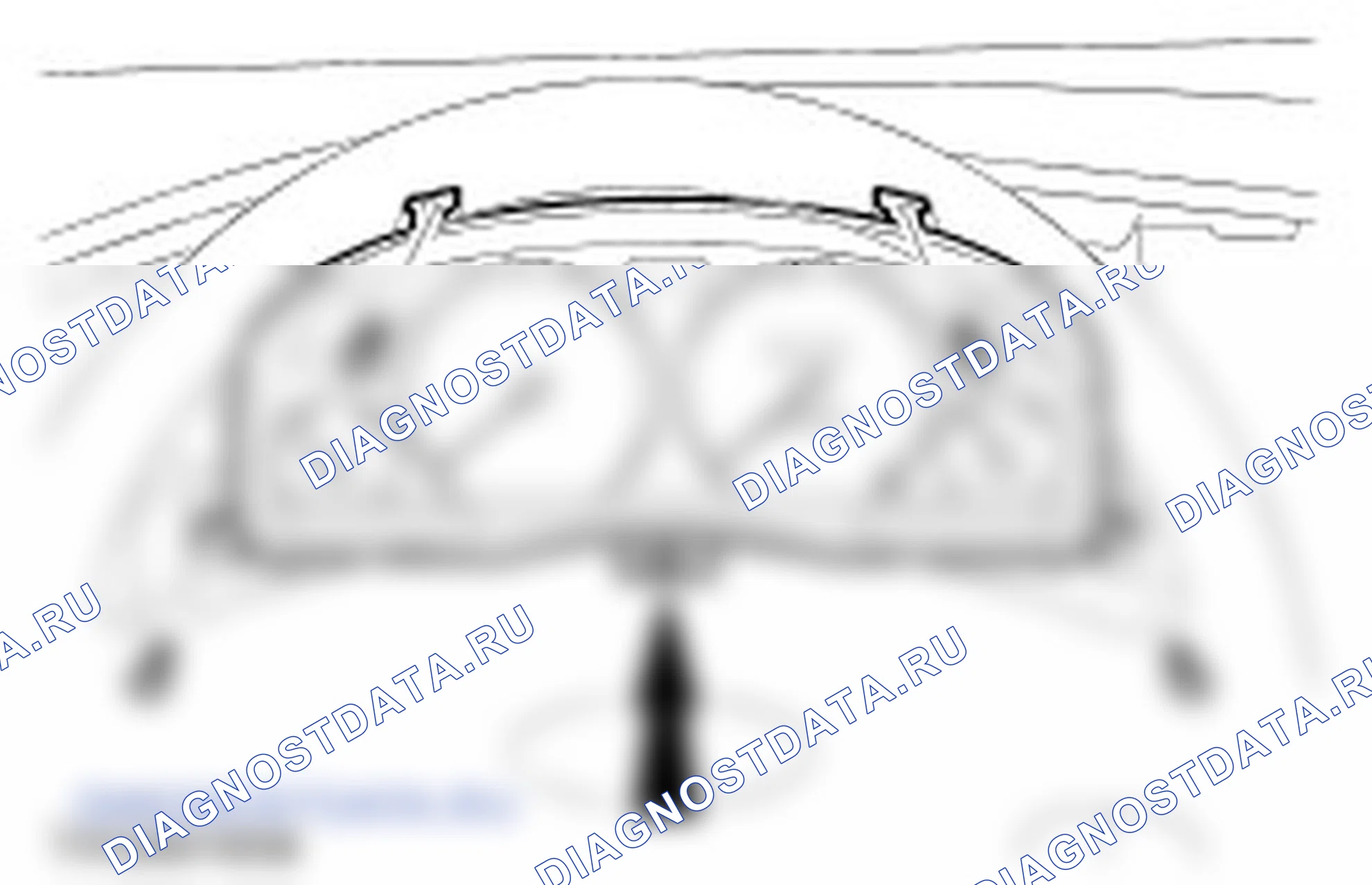 Как снять и установить щиток приборов (IPC). Ford Mondeo II