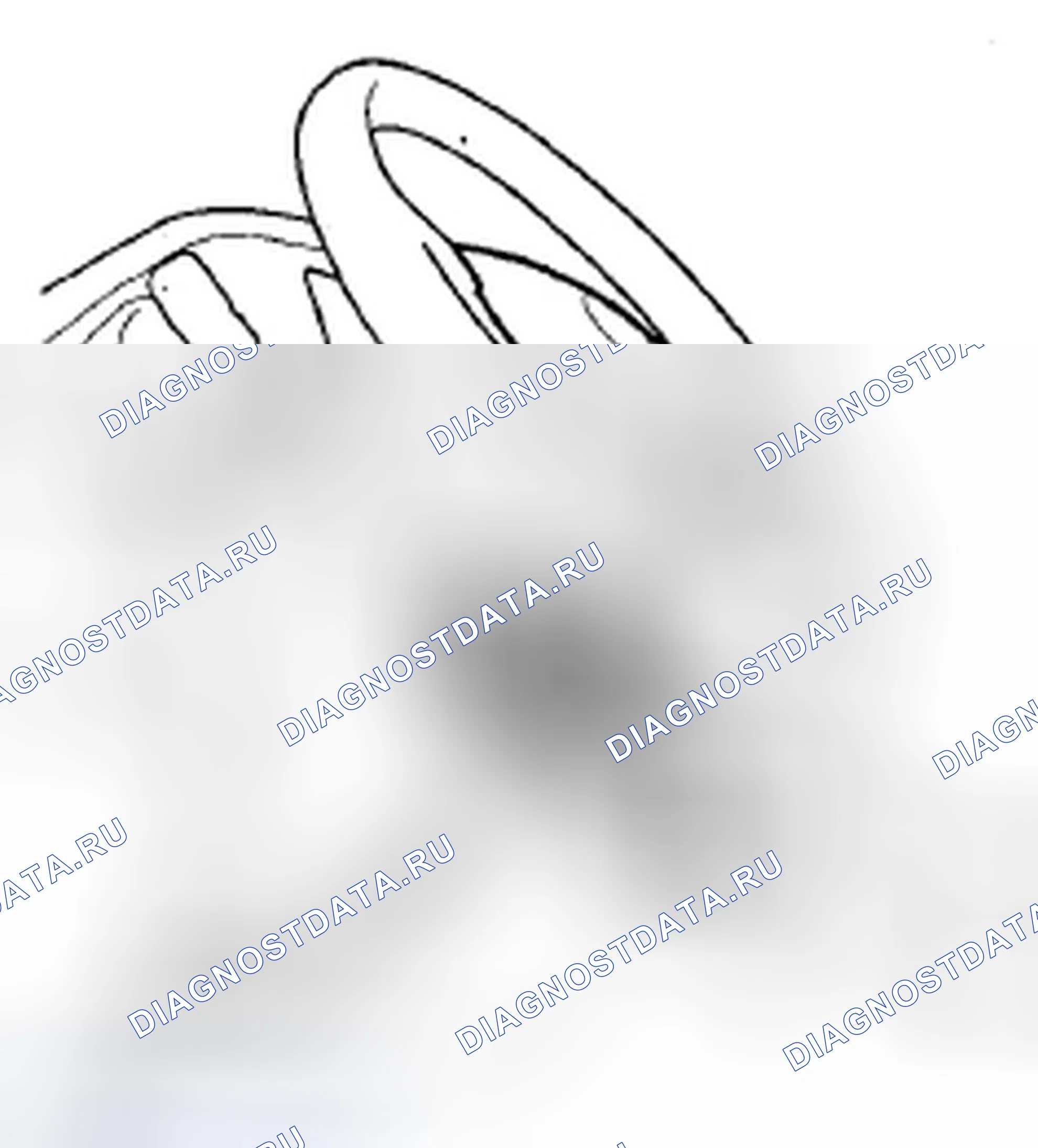 Рис. 194: Удаление. Acura ZDX I