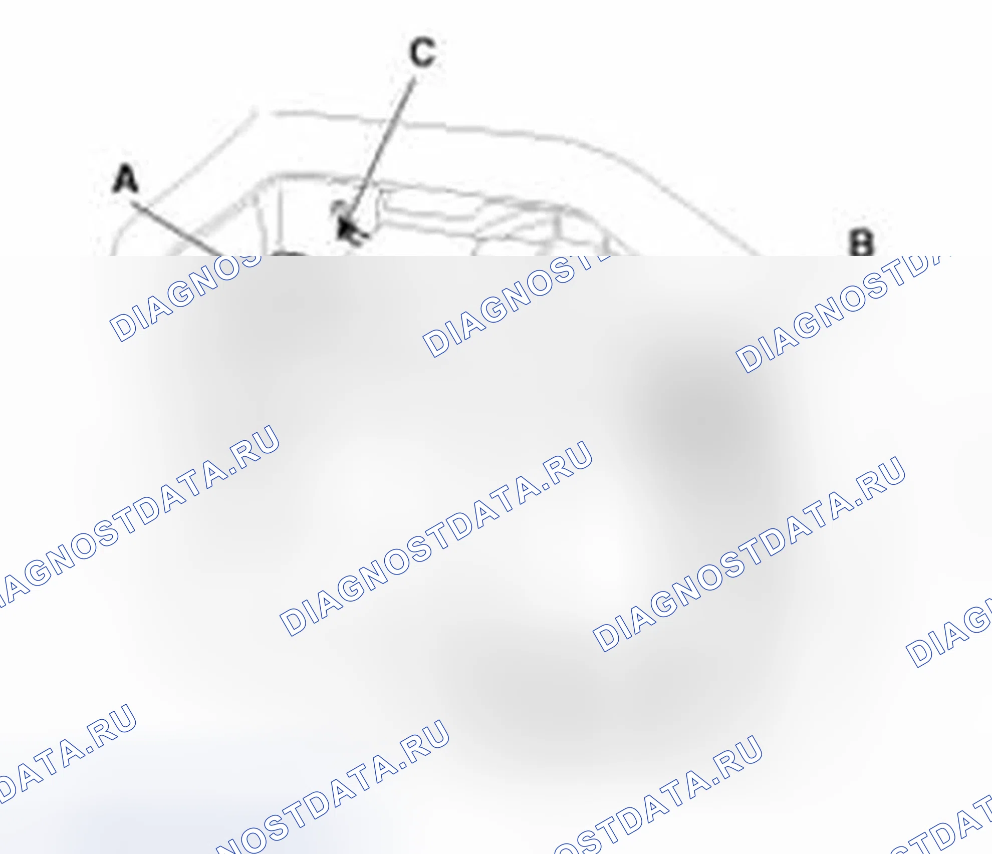Рис. 5: Демонтаж и монтаж. Hyundai Sonata VI