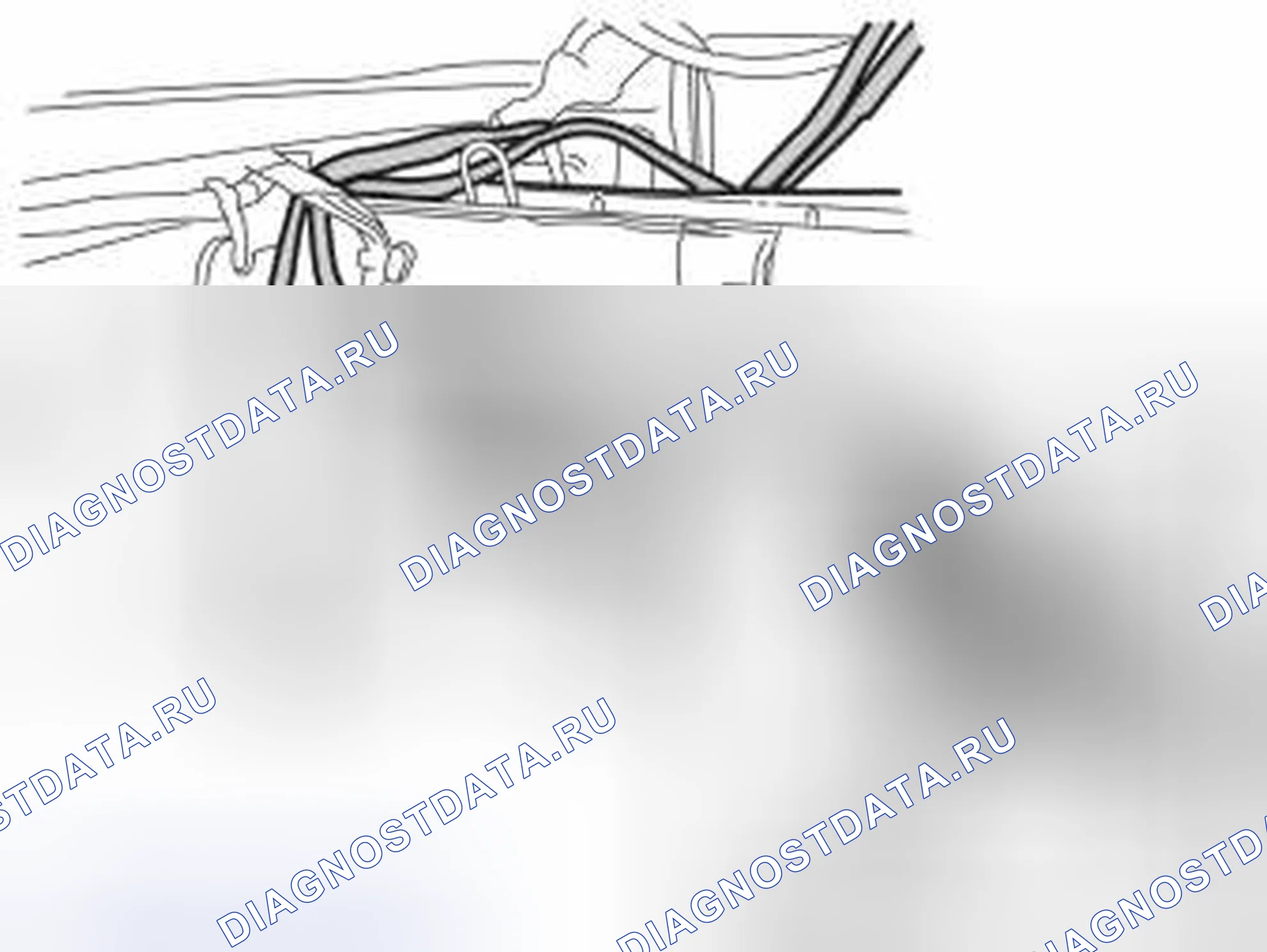 Рис. 435. Volvo V70 II рестайлинг