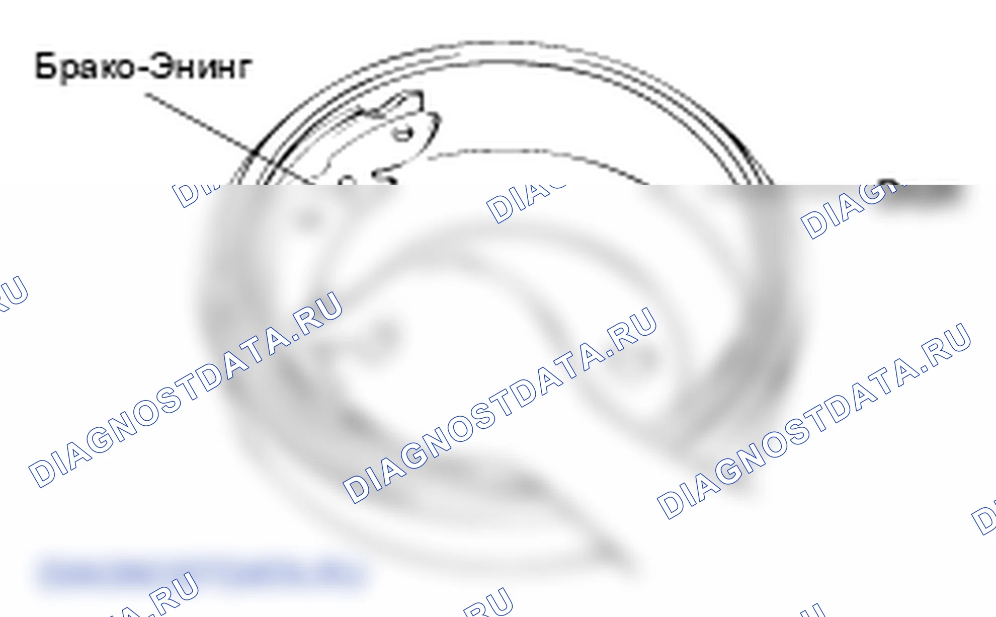 Принцип работы заднего барабанного тормоза. Hyundai Accent LC