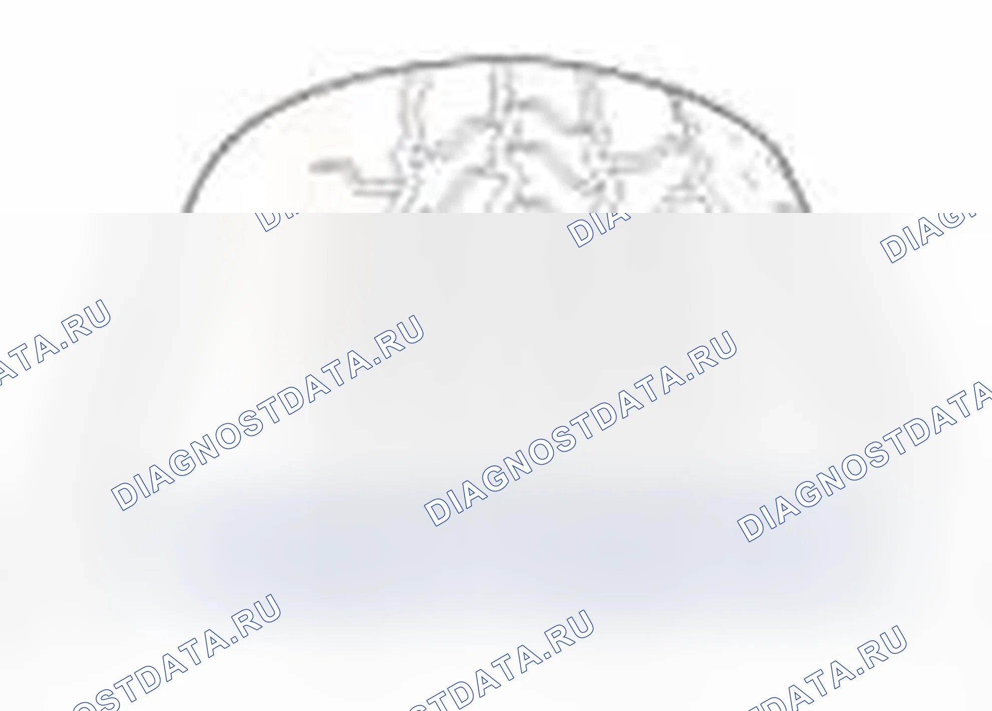 Рис. 135. Hyundai Sonata VI